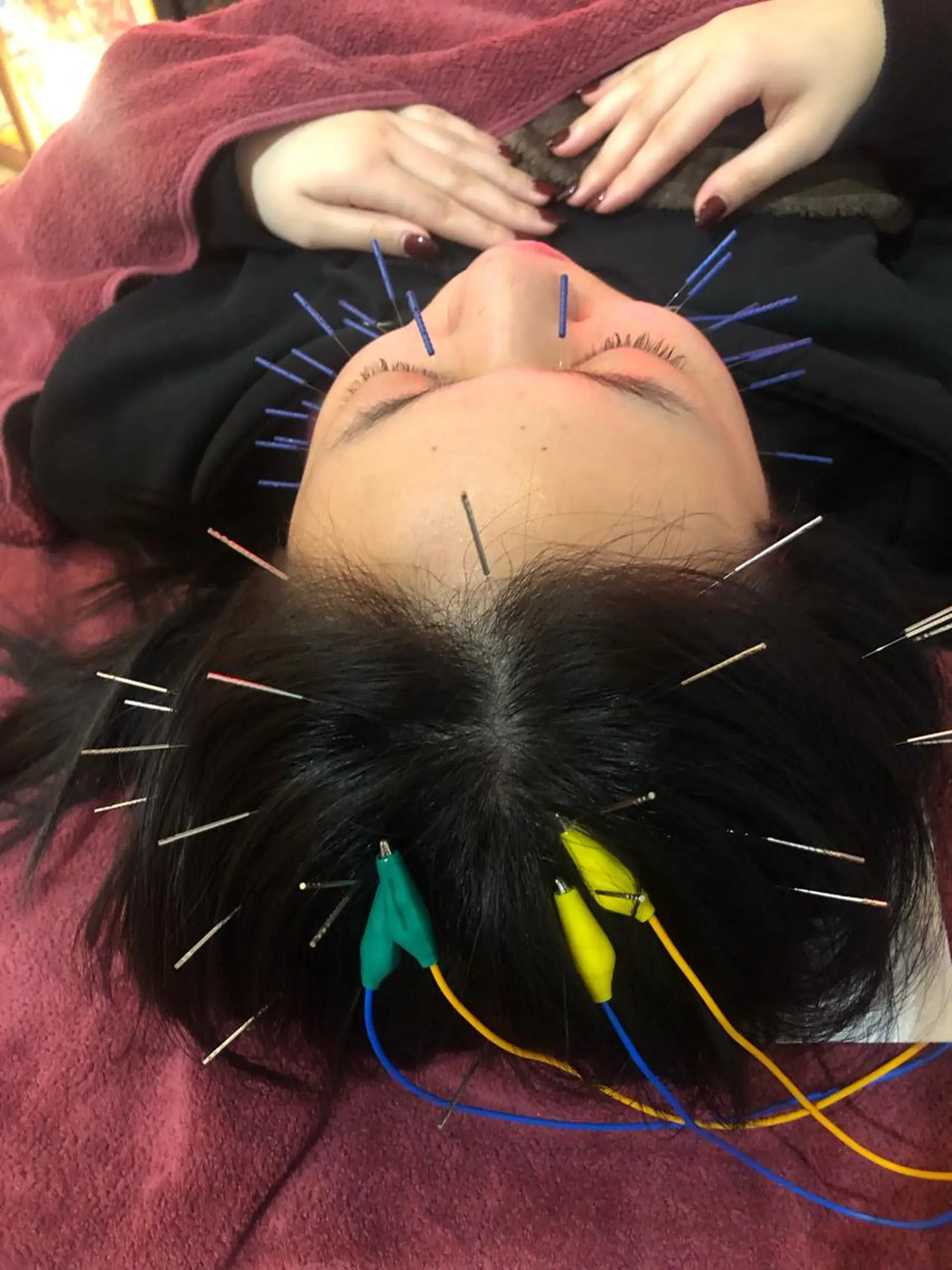 エステ リラク 美容鍼灸女性専用 りんご鍼灸治療院のエステ・リラクイメージ