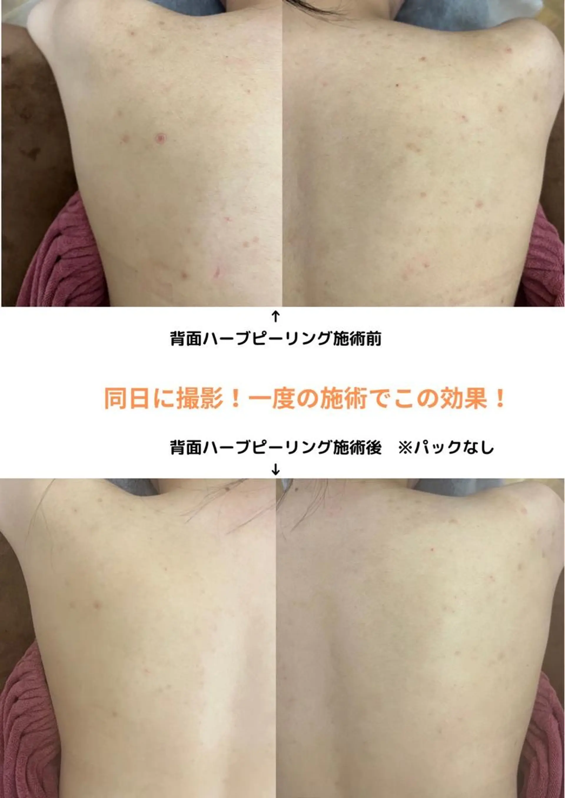 エステ リラク ベルーテ エッセンスのエステ・リラクイメージ