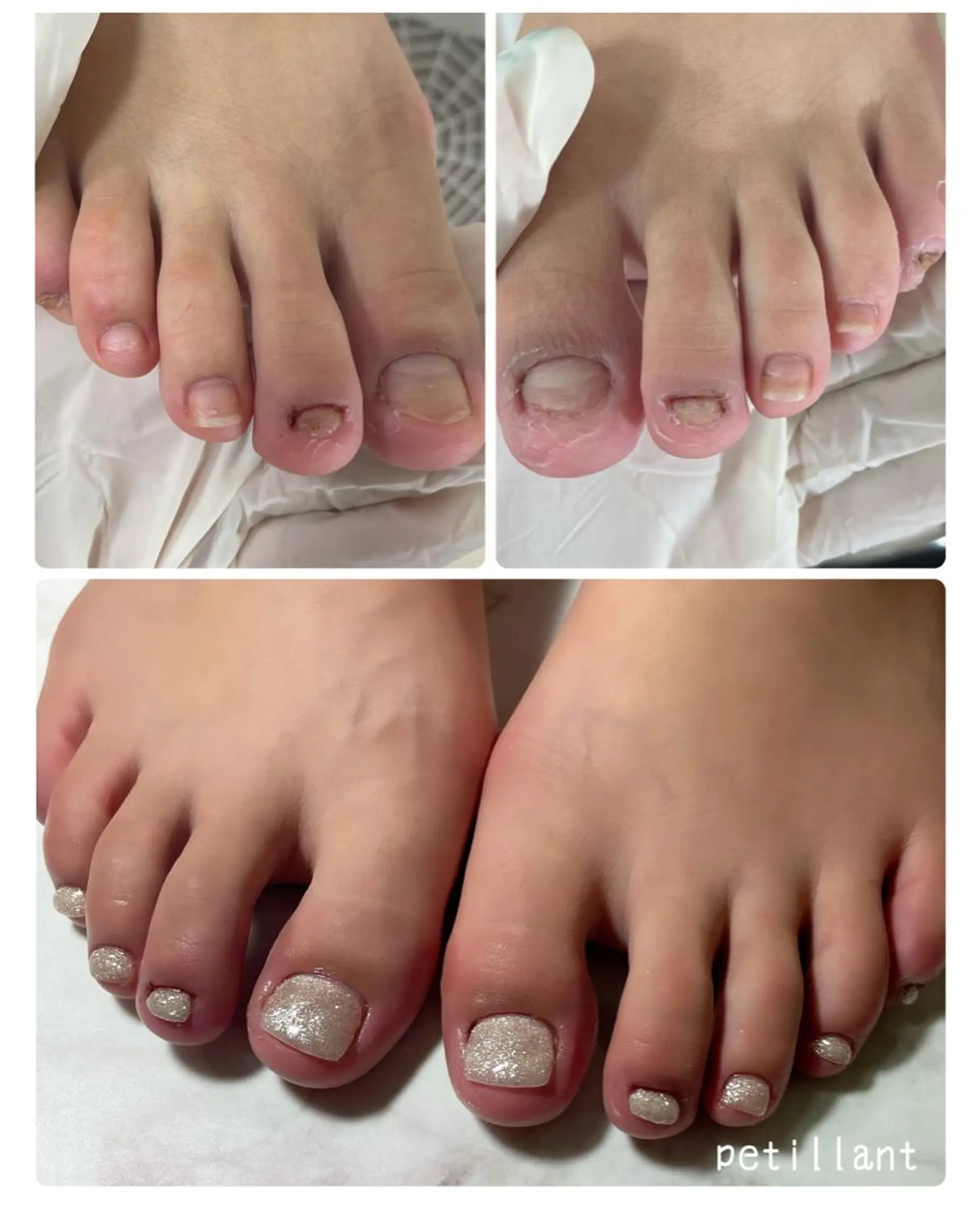 ネイル 長さ出し petillant所属・nail salon petillantのネイルデザイン