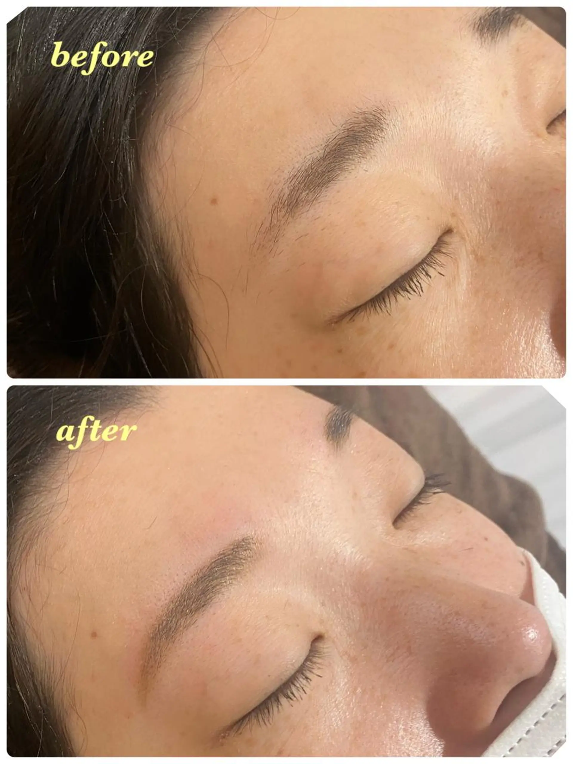 アイブロウ ハーブピーリング/韓国肌管理/フェイシャル/毛穴洗浄/眉毛/顔脱毛【糸脱毛専門】rev所属・ハーブピーリング🌹 毛穴洗浄❤️眉waxのエステ・リラクイメージ