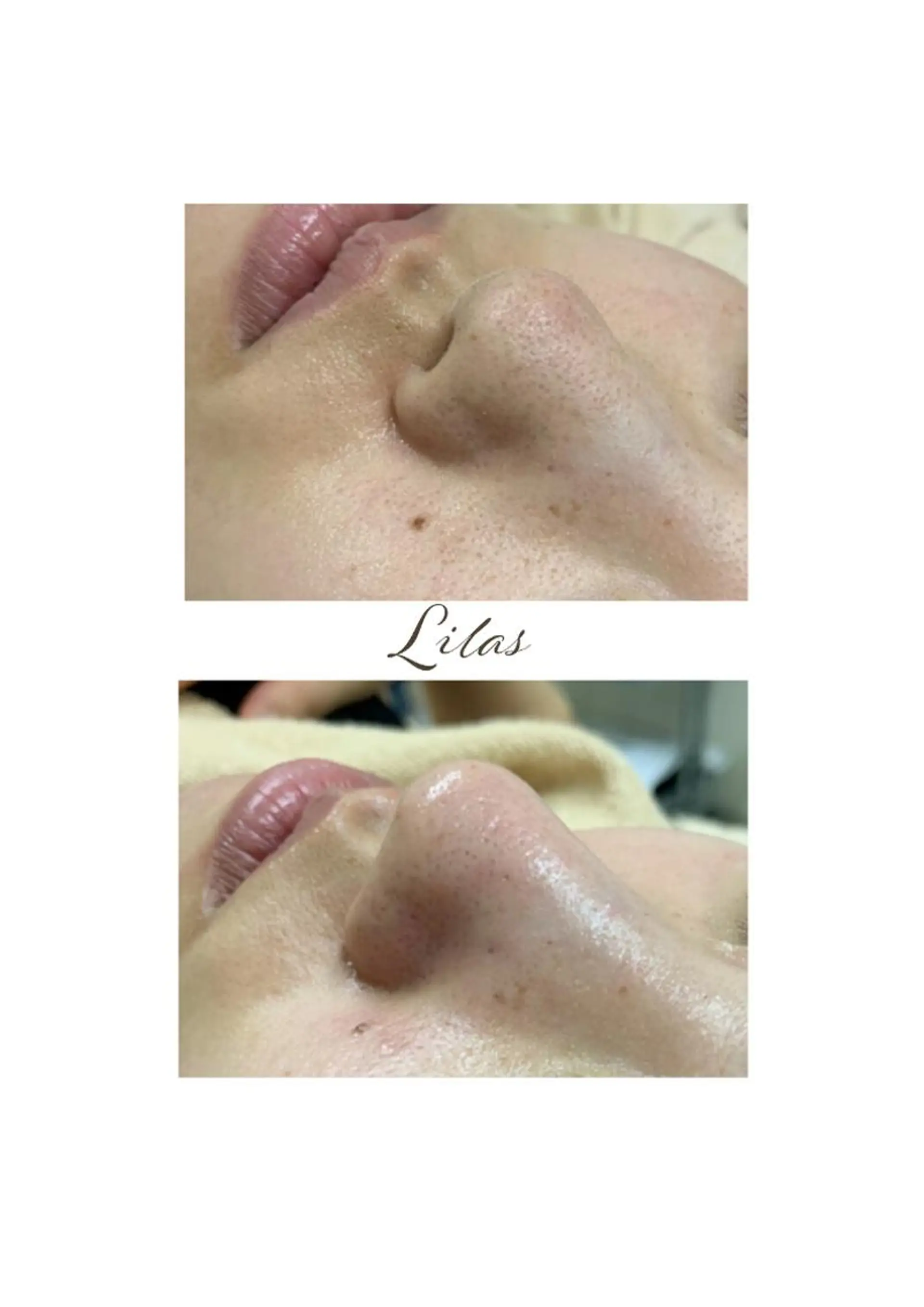 Lilas 【リラ】 小野かづさのエステ・リラクイメージ