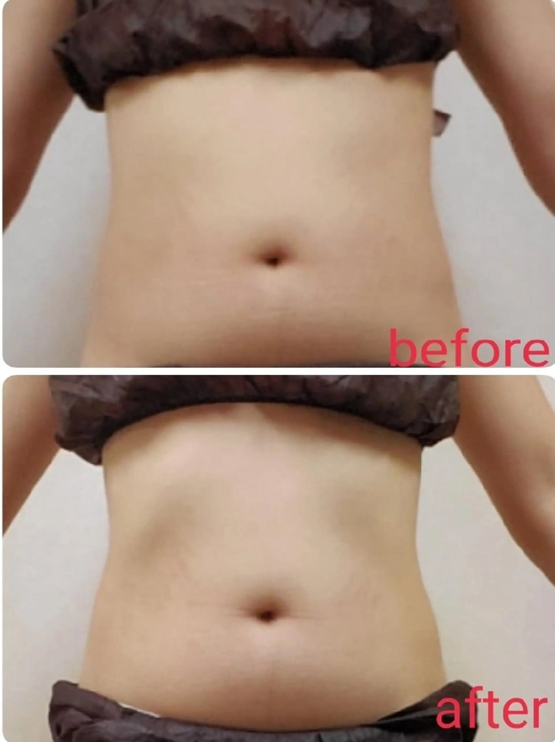 エステ リラク 【 Laforme】 ラ・フォルムのエステ・リラクイメージ