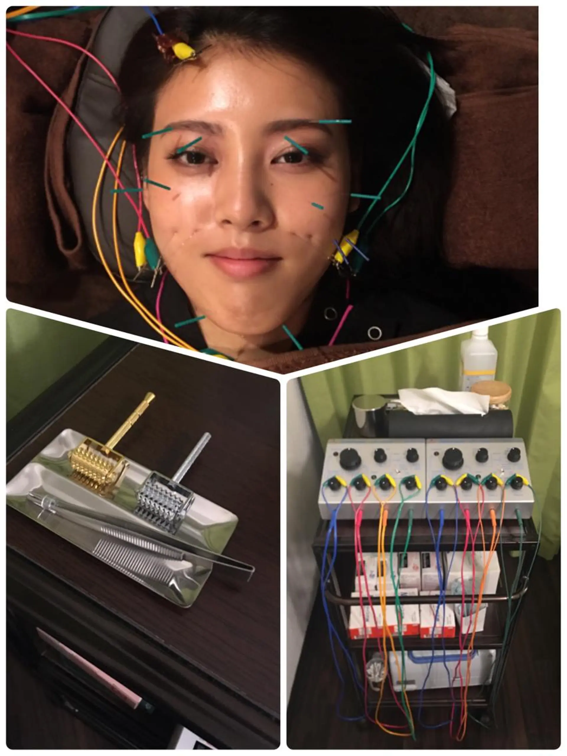 表参道鍼灸院K 美容鍼🔮ララピールのエステ・リラクイメージ