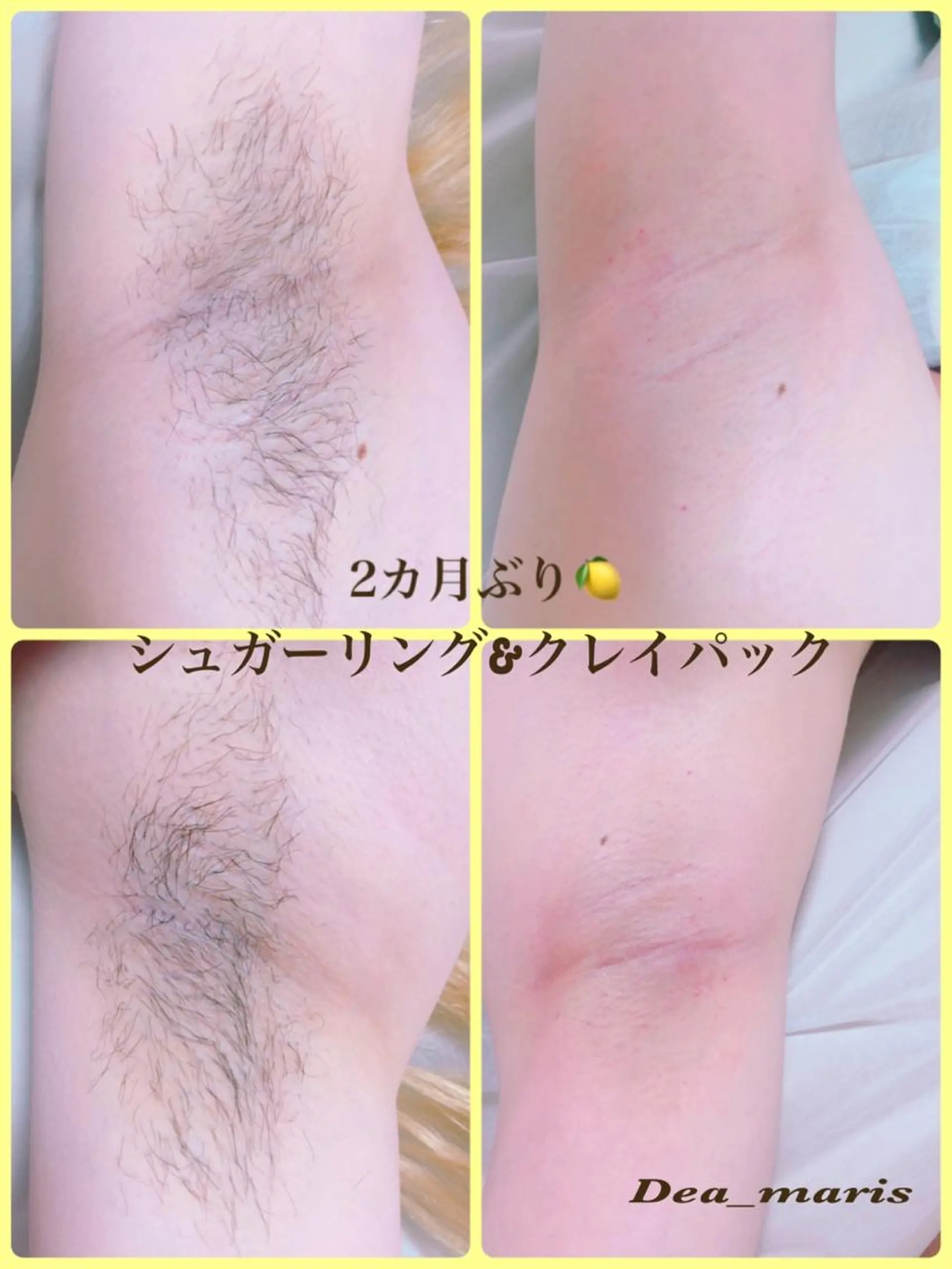 private salon  Dea_maris シュガーリング＆パーソナルボディケア所属・シミ改善・韓国肌管理 ボディメイク痩身のその他イメージ