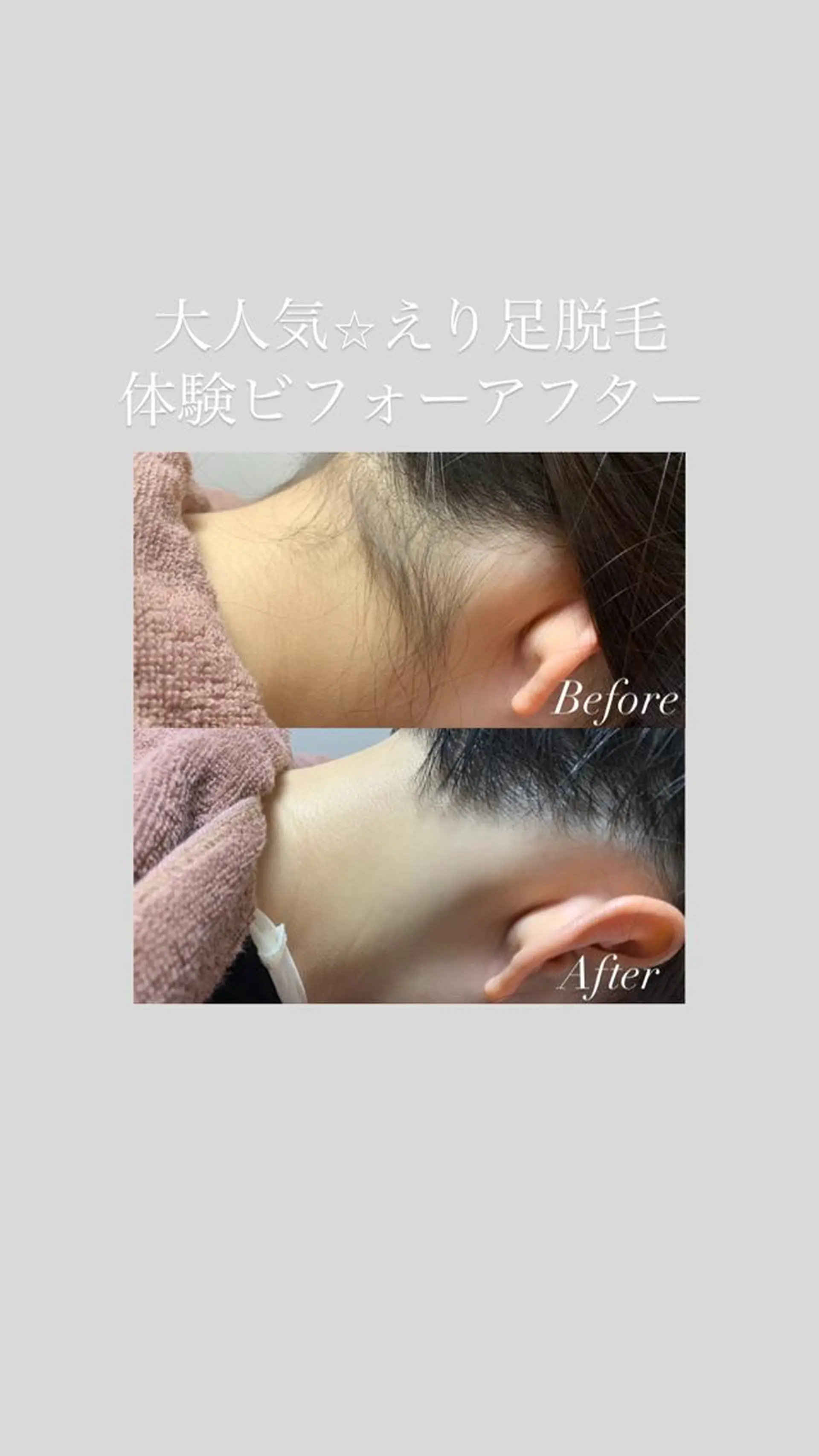 脱毛 透明感の肌Lino malieのエステ・リラクイメージ