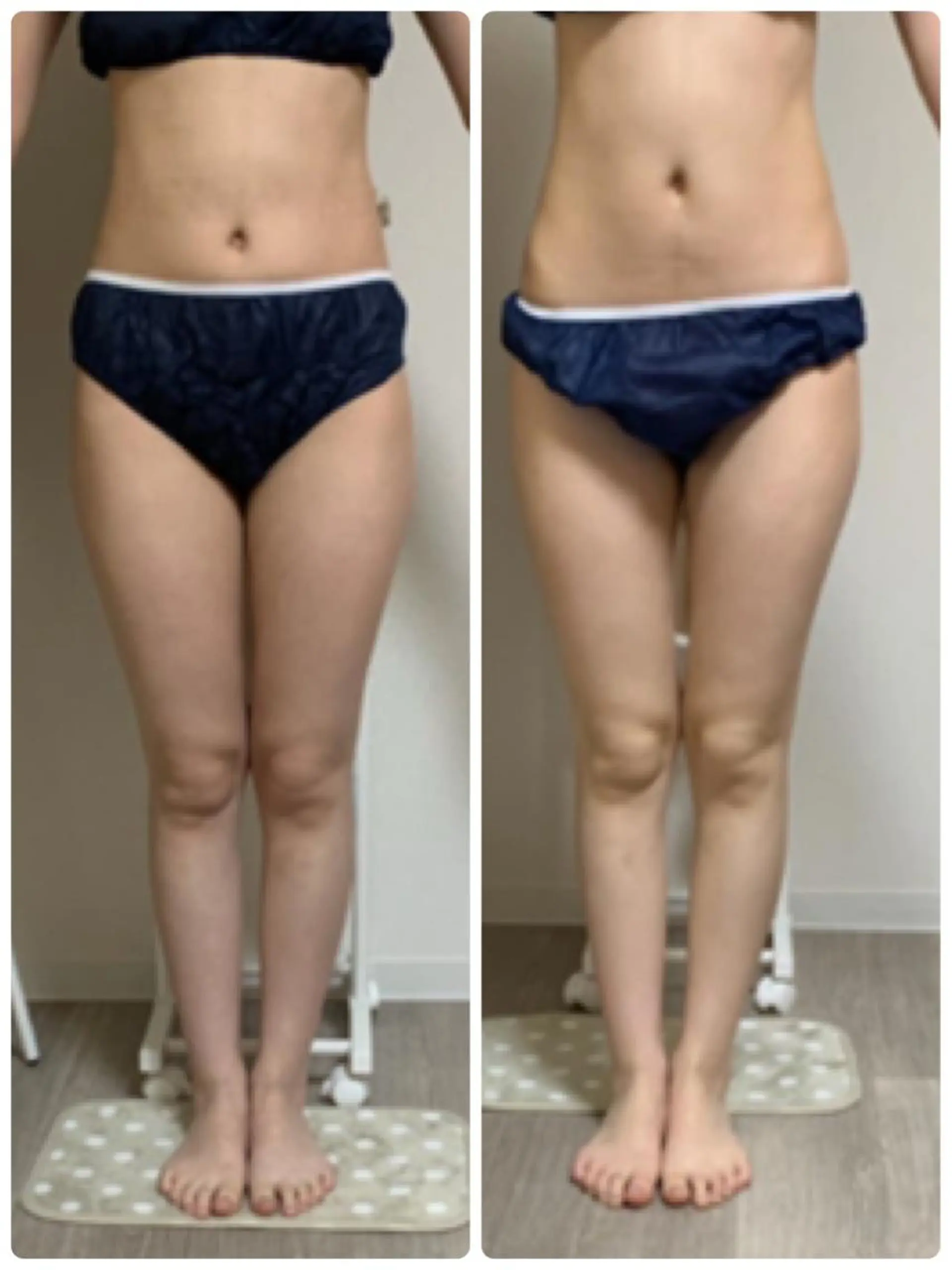 美ボディメイクサロン　only one body所属・所沢 痩身エステサロンのエステ・リラクイメージ