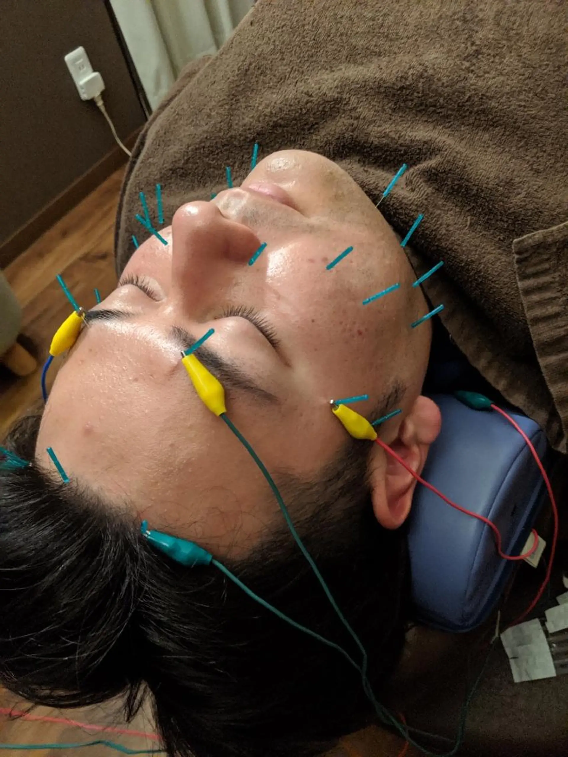 乃々鍼灸・整体院　表参道所属・乃々鍼灸整体院　植木 　【美容鍼/整体】のエステ・リラクイメージ