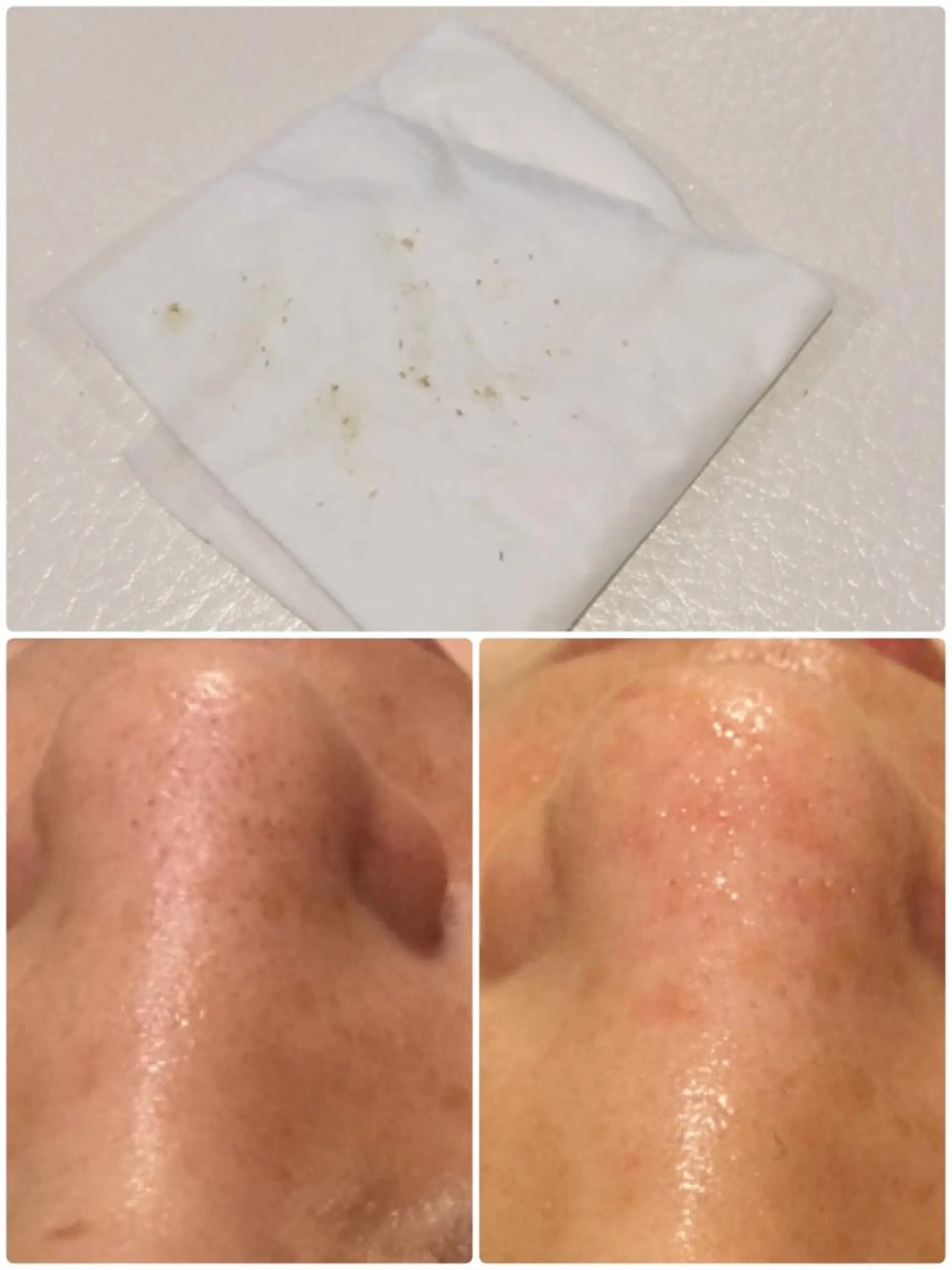 エステ 【リベルハーブピーリング認定店】敏感肌・美白脱毛専門店Dione立川店所属・Dione 立川店のエステ・リラクイメージ