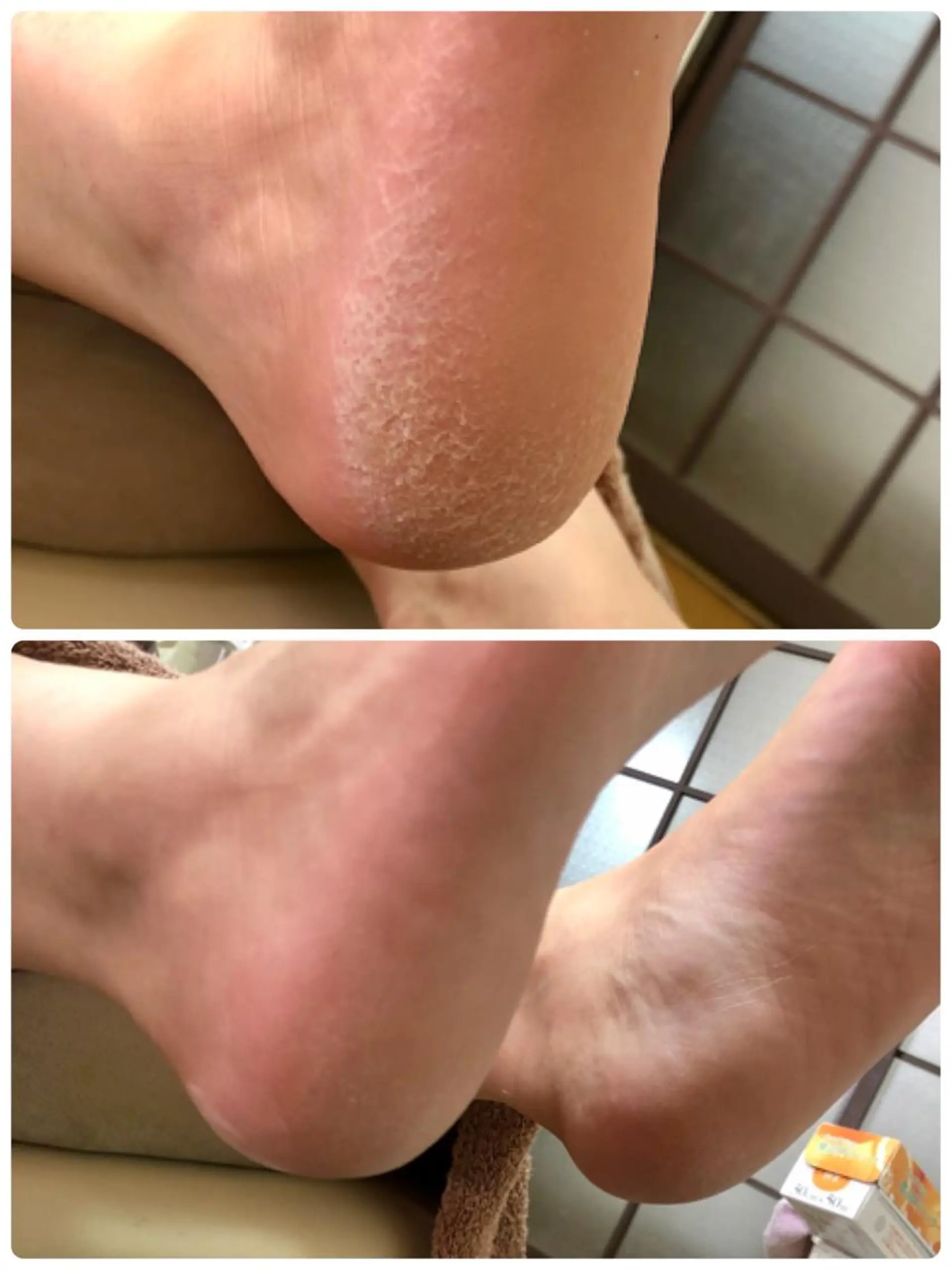 ❤︎MN❤︎ モンのエステ・リラクイメージ