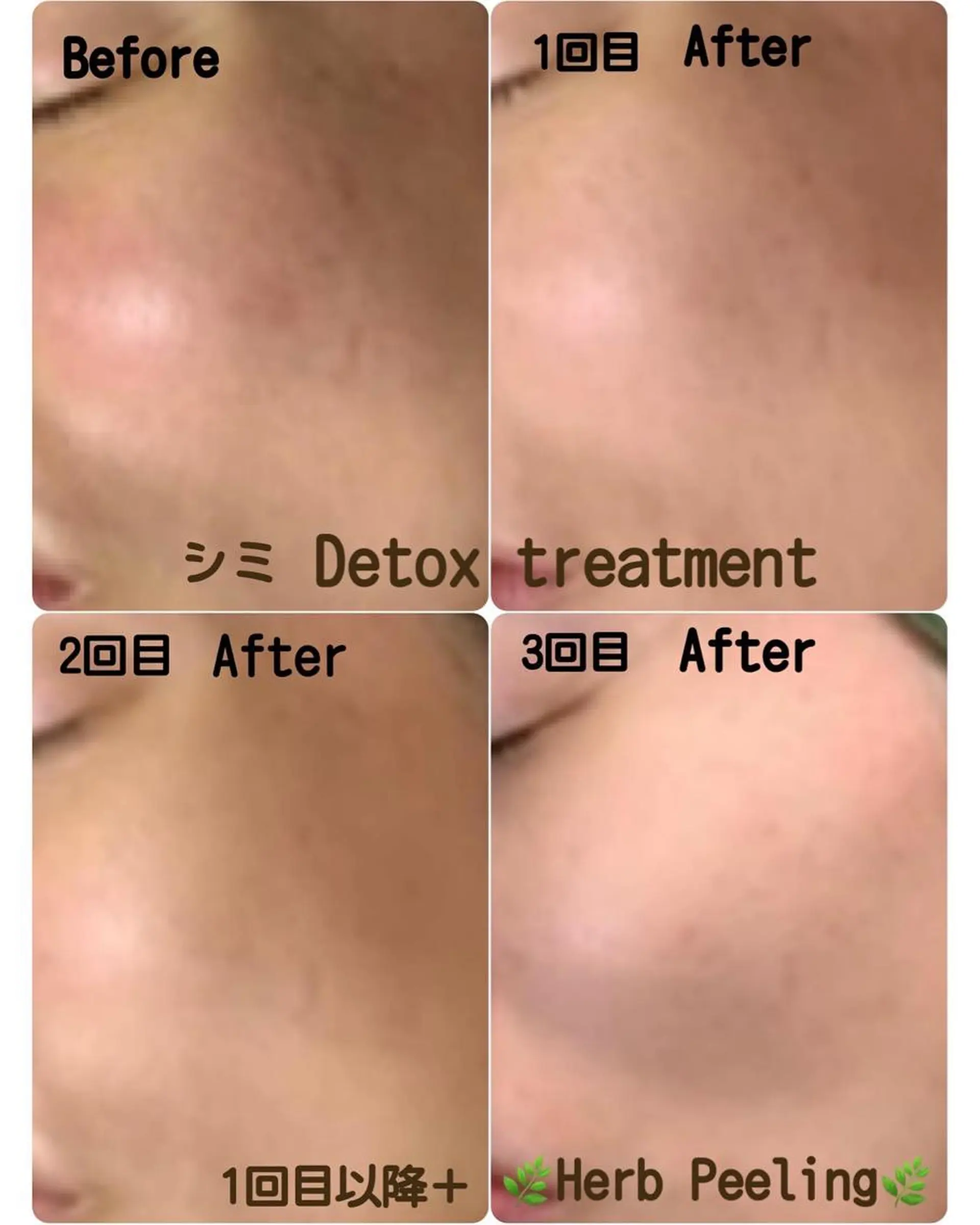 エステ ヴィーナス ビューティーのエステ・リラクイメージ