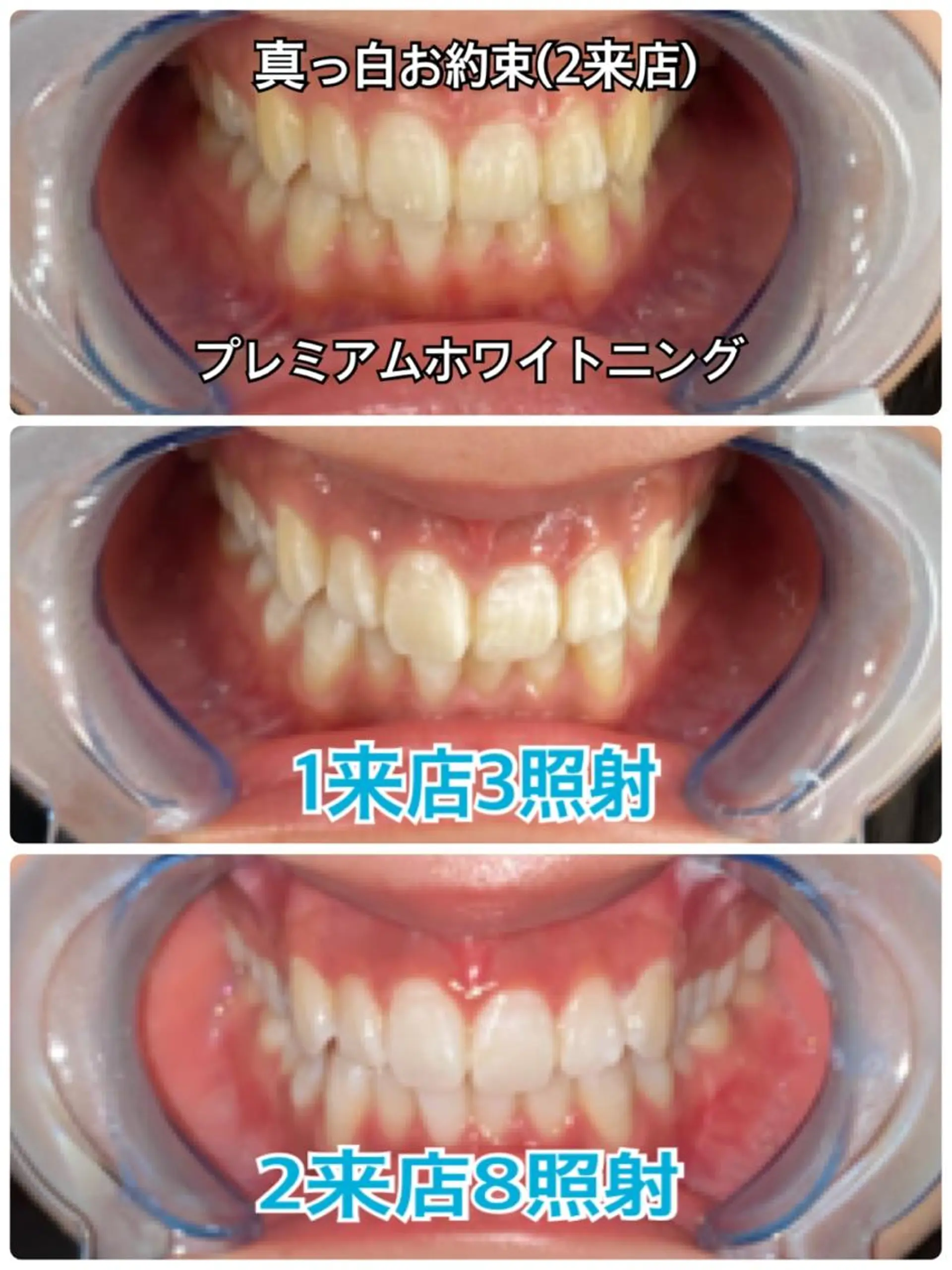 Platinum Beauty 四条烏丸店所属・吉田亮利 ホワイトニング専門店のその他イメージ