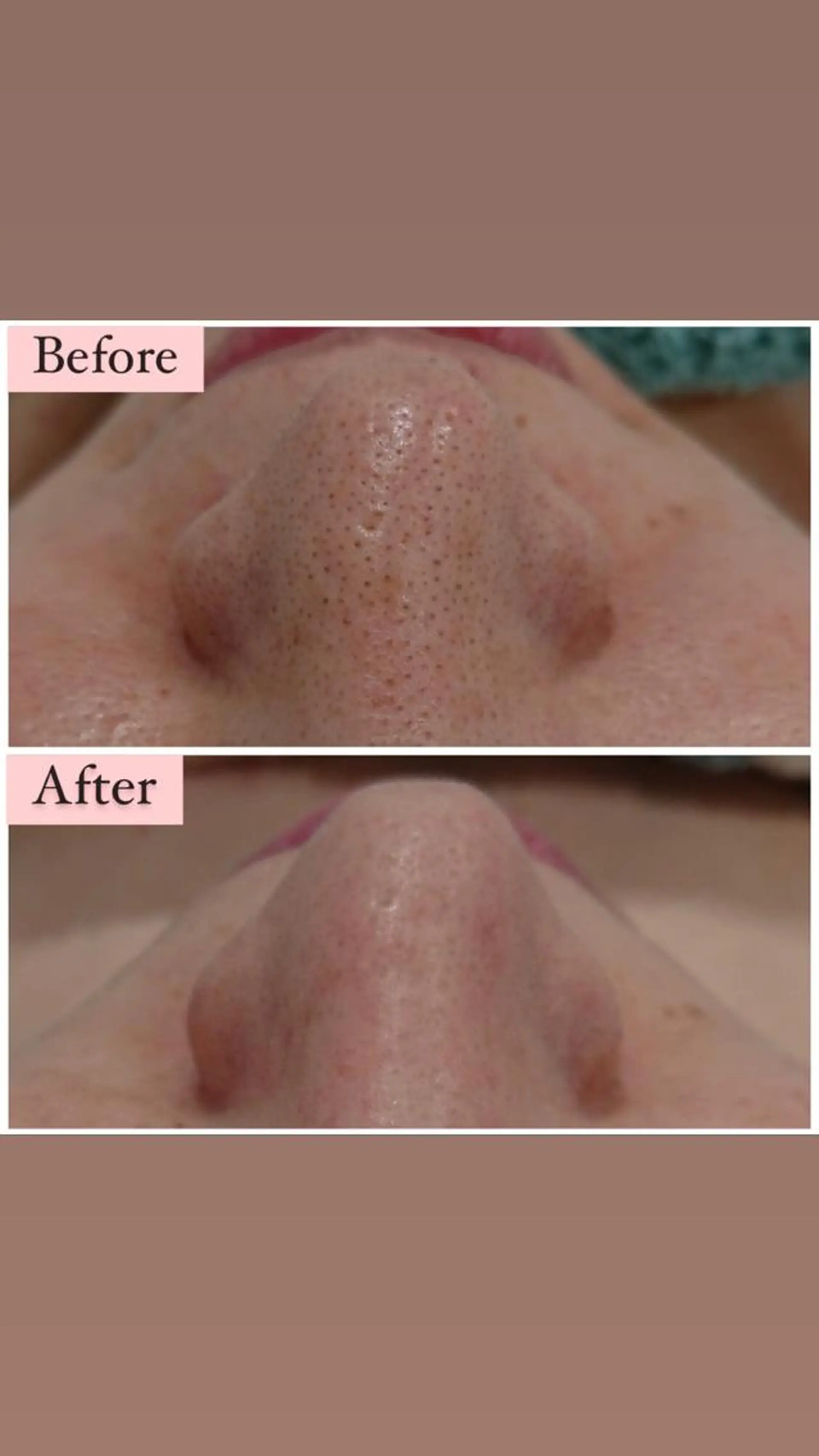 ハーブピーリング専門 muro.のエステ・リラクイメージ