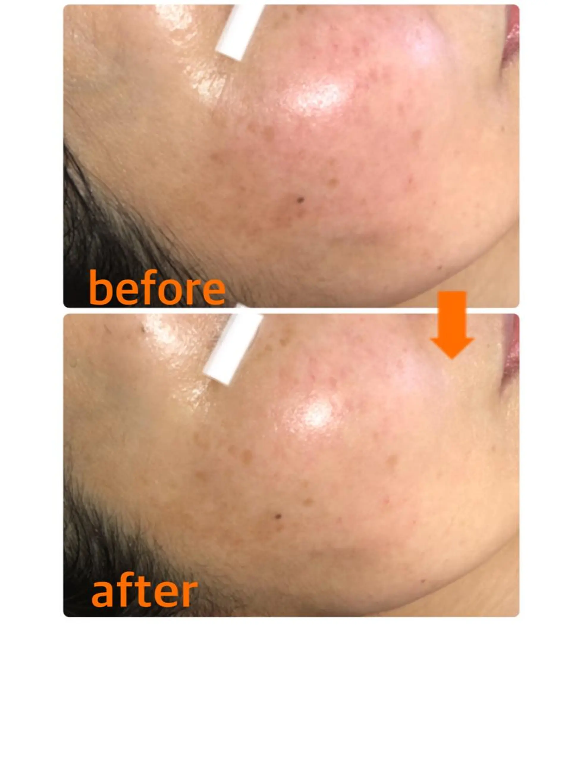 小顔・毛穴・たるみ ネイル　似内真樹のエステ・リラクイメージ