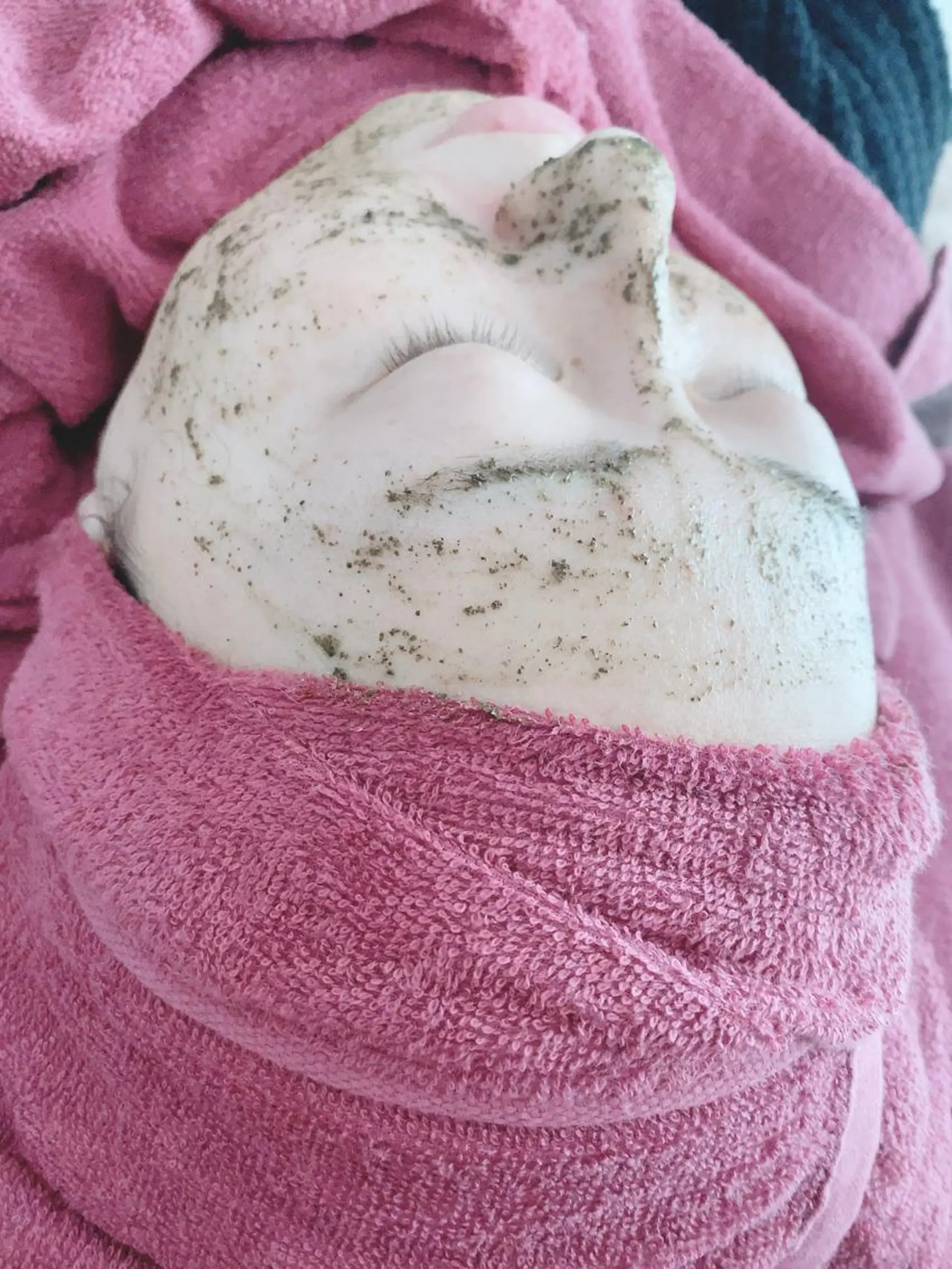 エステ Chalon所属・REVI取扱・肌悩み 毛穴Chalonのエステ・リラクイメージ