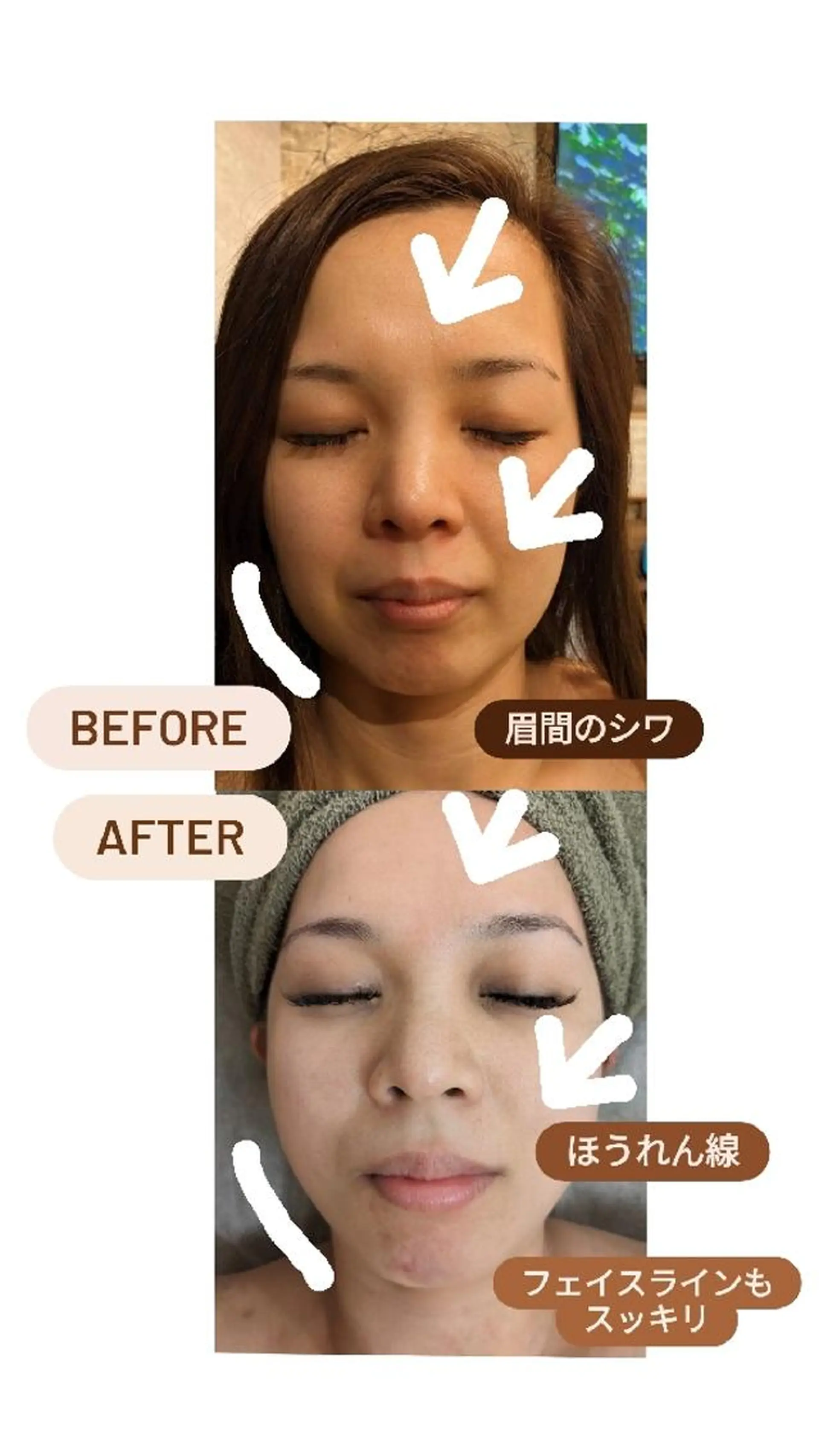 プライベートサロン宿り木所属・江坂@宿り木　脱毛＆ 耳ツボジュエリーのその他イメージ