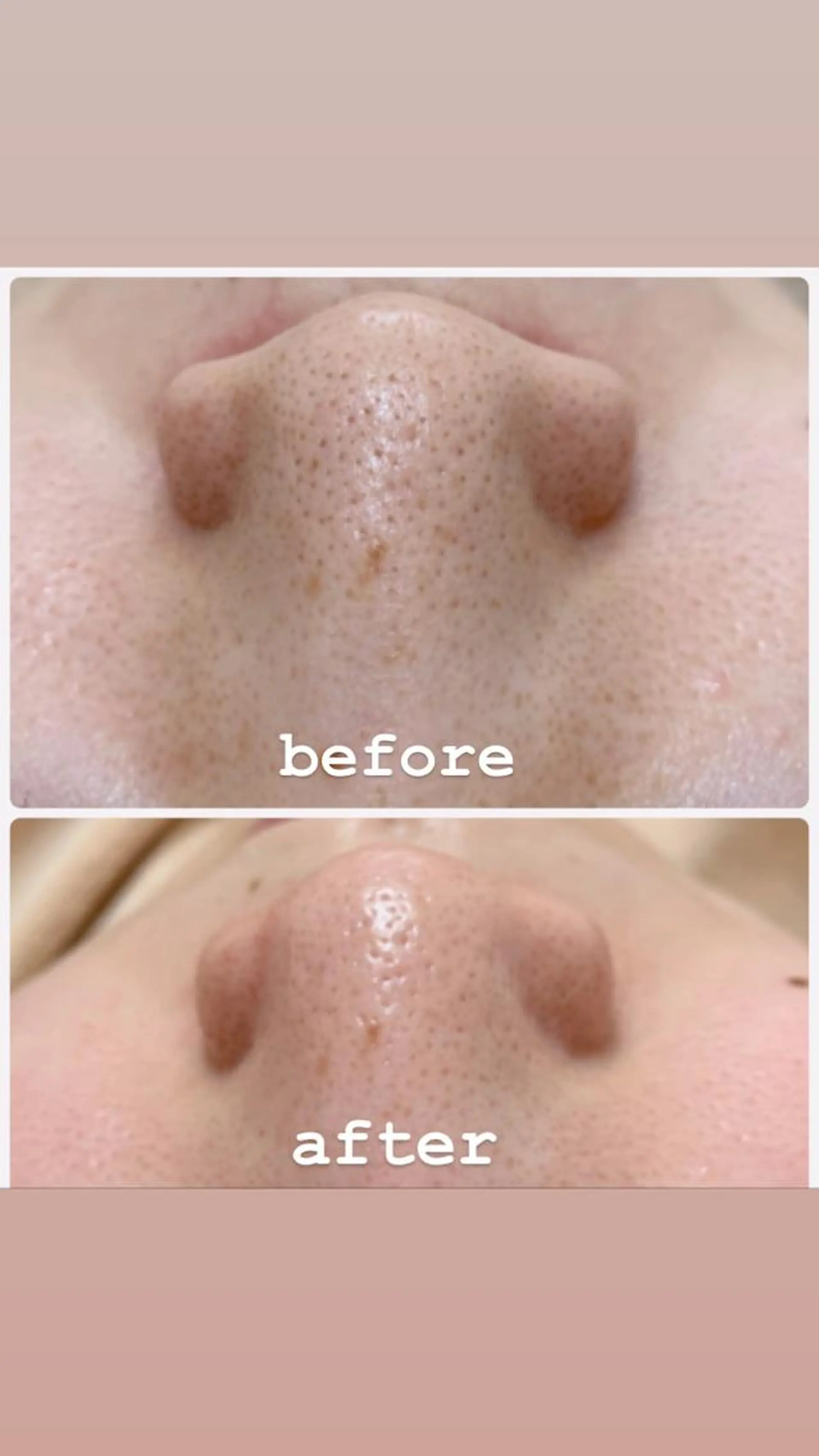 グランデ ルシアルのエステ・リラクイメージ