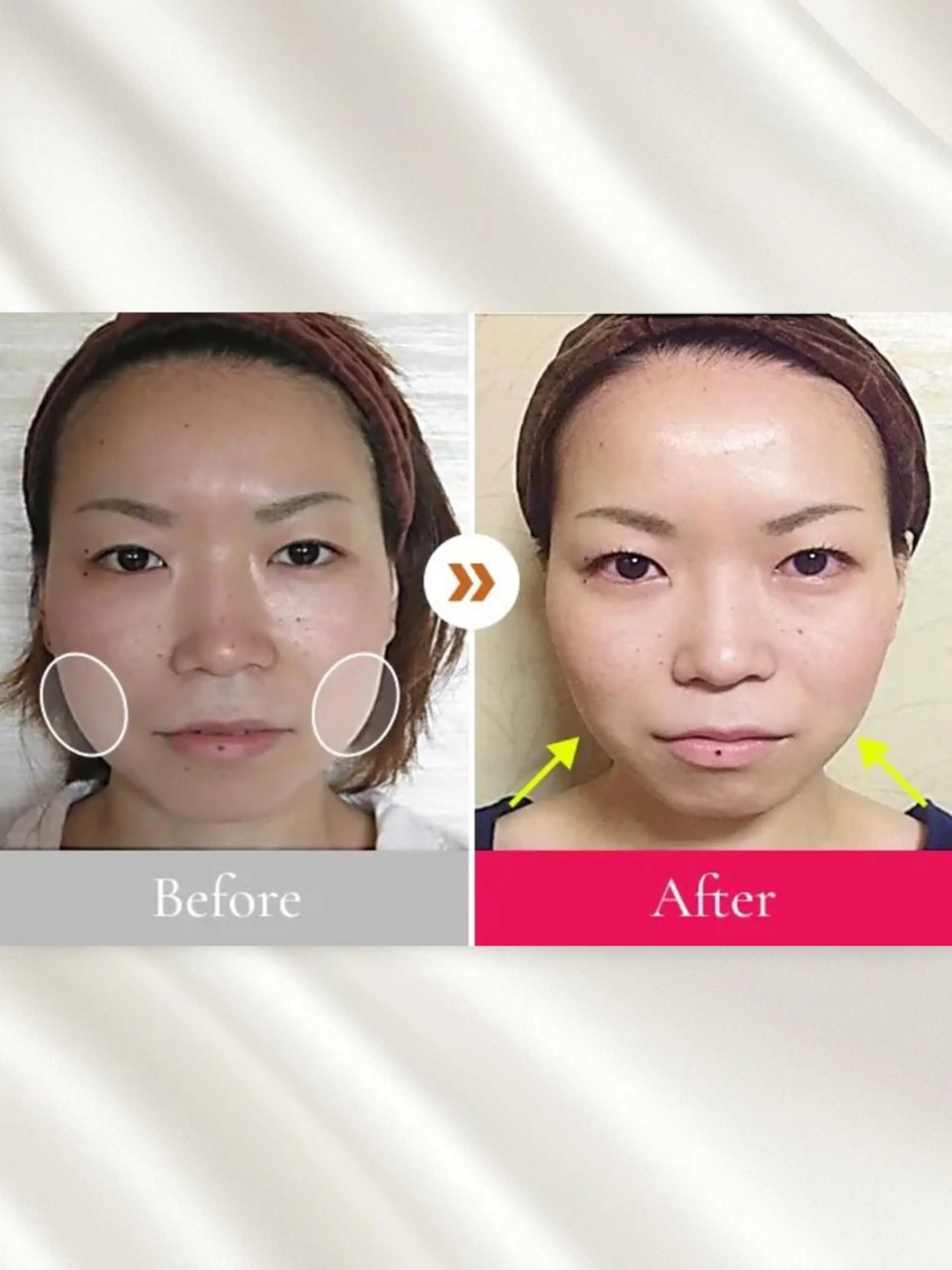 小顔整体研究所 KSラボ川崎店のエステ・リラクイメージ