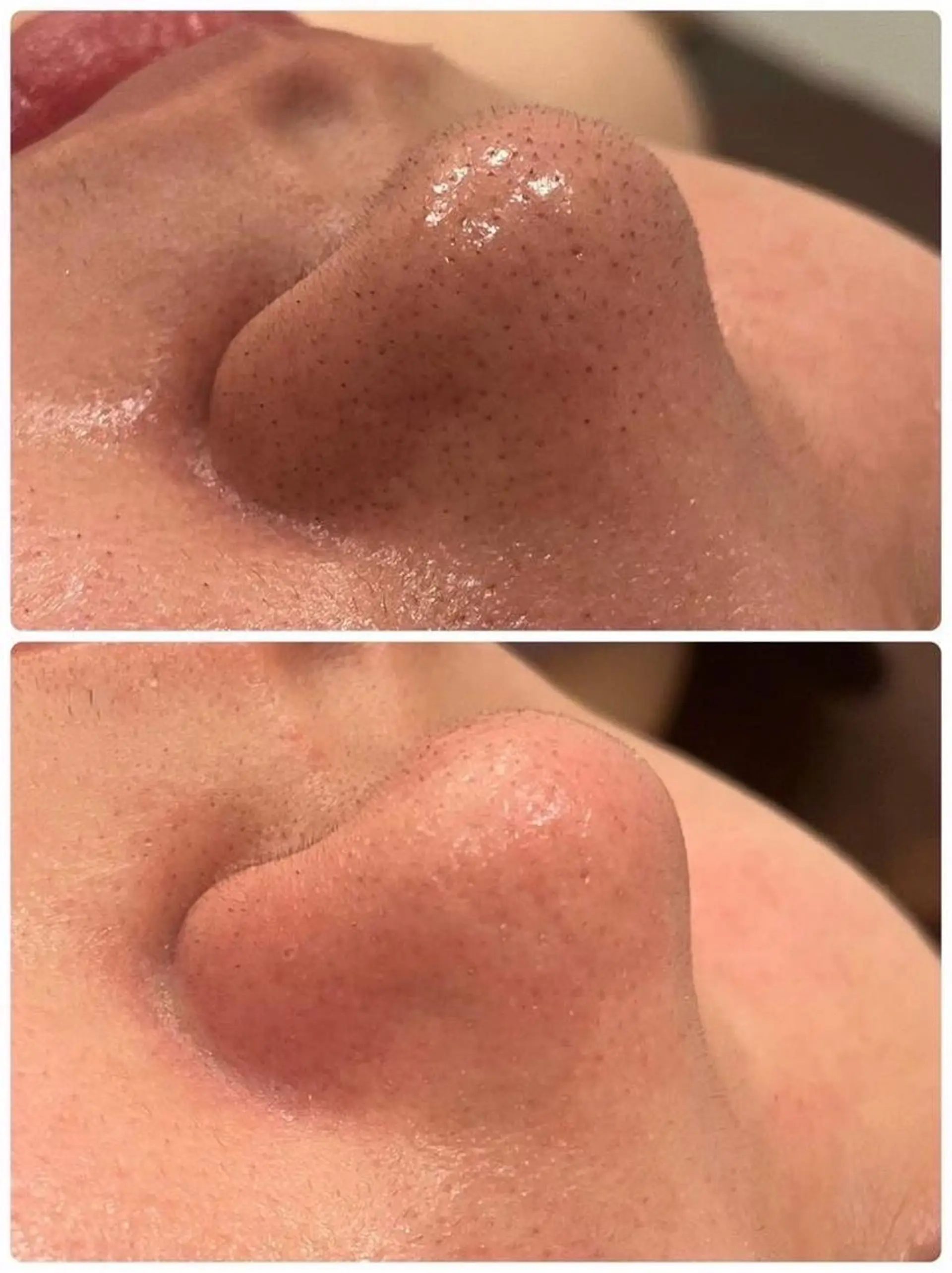 メンズ エステ トータルクリア 田岡のエステ・リラクイメージ