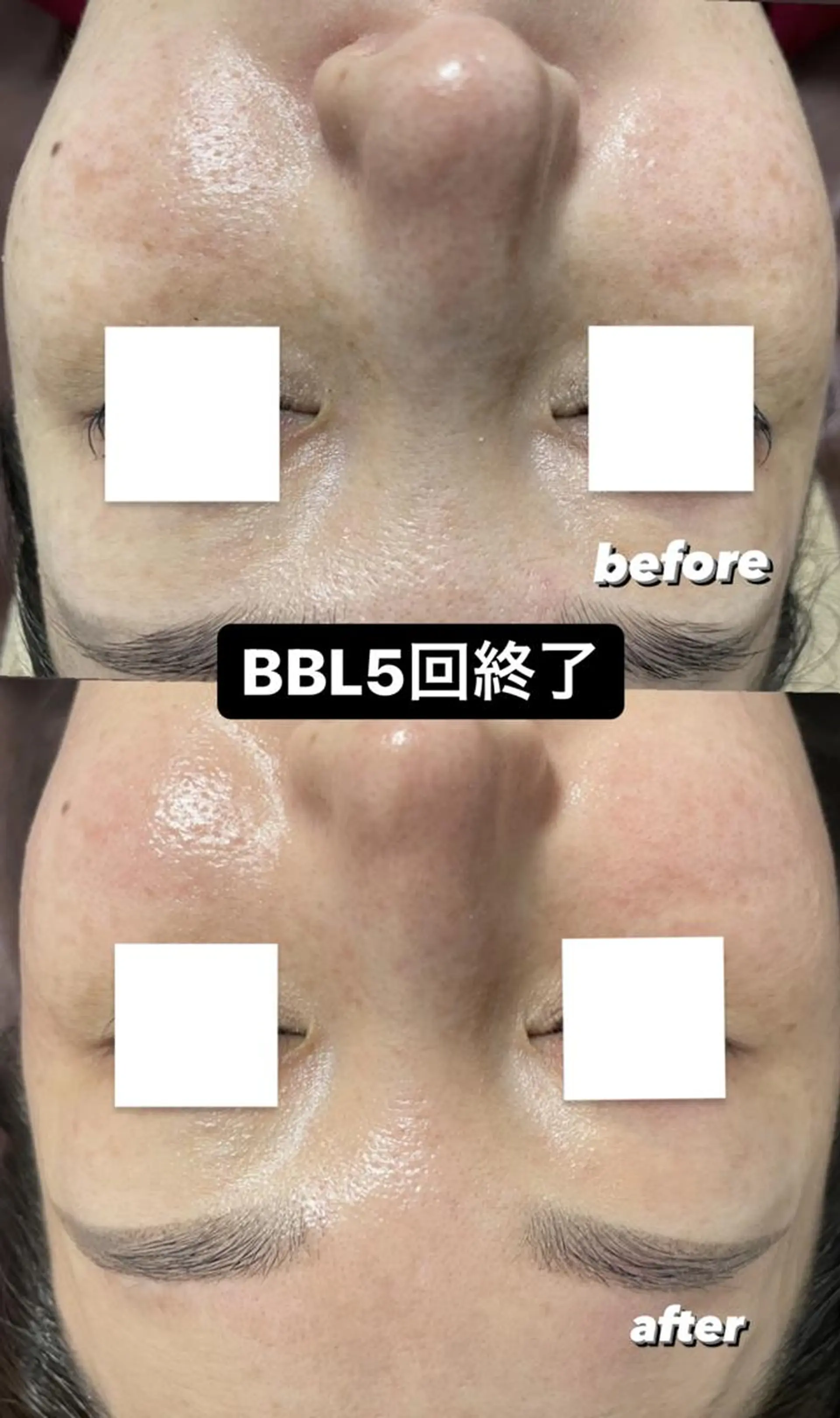 ネイル キッズ メンズ 脱毛 Epina 千葉店 【エピナ】のエステ・リラクイメージ