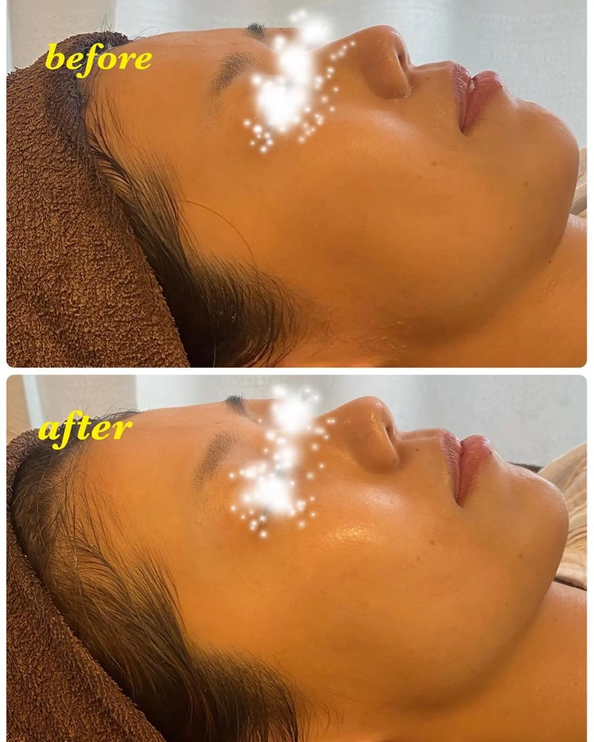 ハーブピーリング/韓国肌管理/フェイシャル/毛穴洗浄/眉毛/顔脱毛【糸脱毛専門】rev所属・ハーブピーリング🌹 毛穴洗浄❤️眉waxのエステ・リラクイメージ