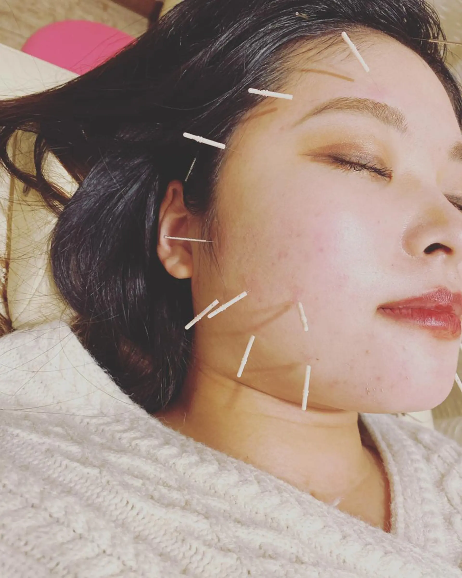 むくみたるみ専門☆ 美容鍼・小顔矯正のエステ・リラクイメージ