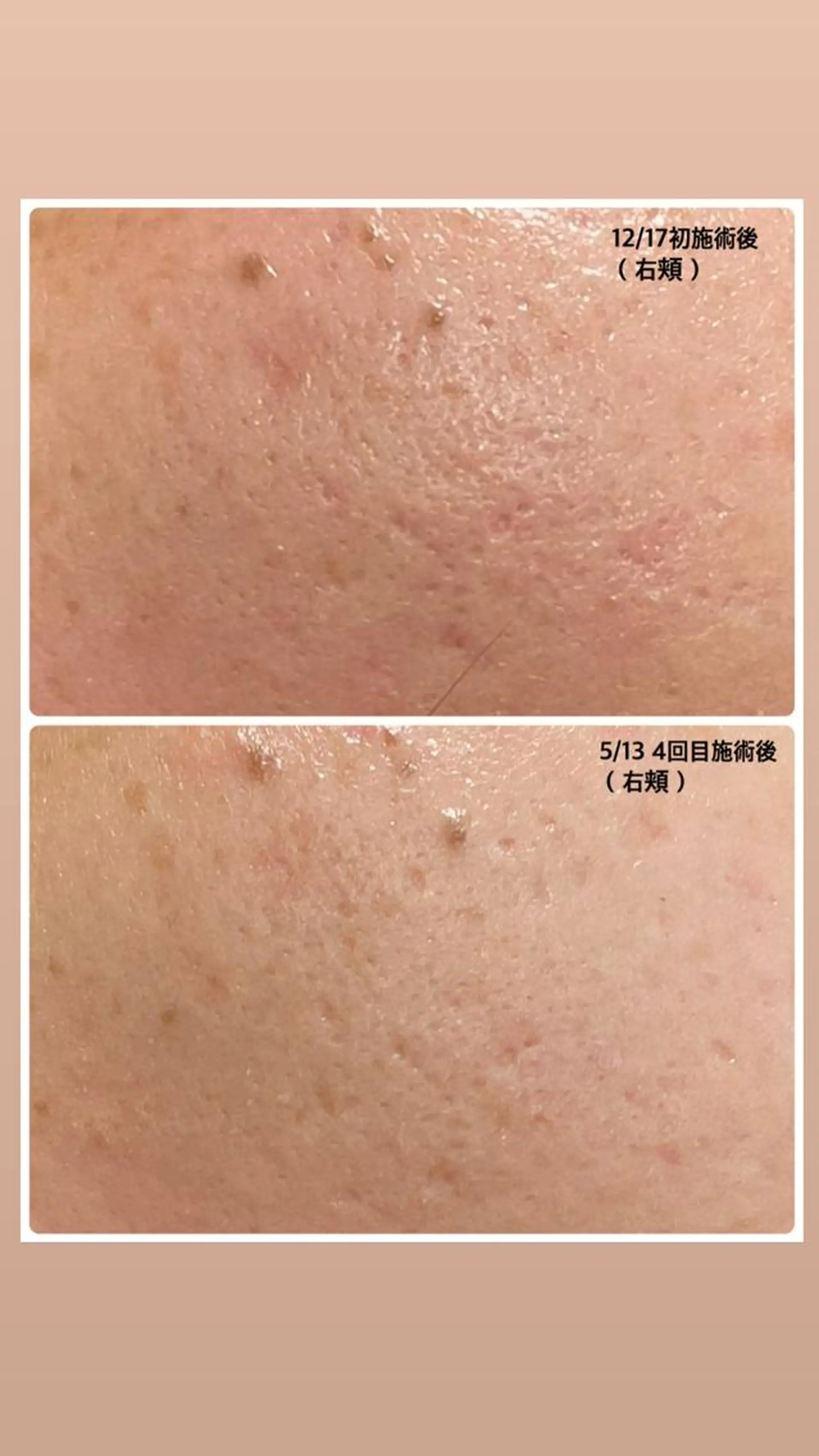 エステ リラク ビューティーサロン Claireのエステ・リラクイメージ