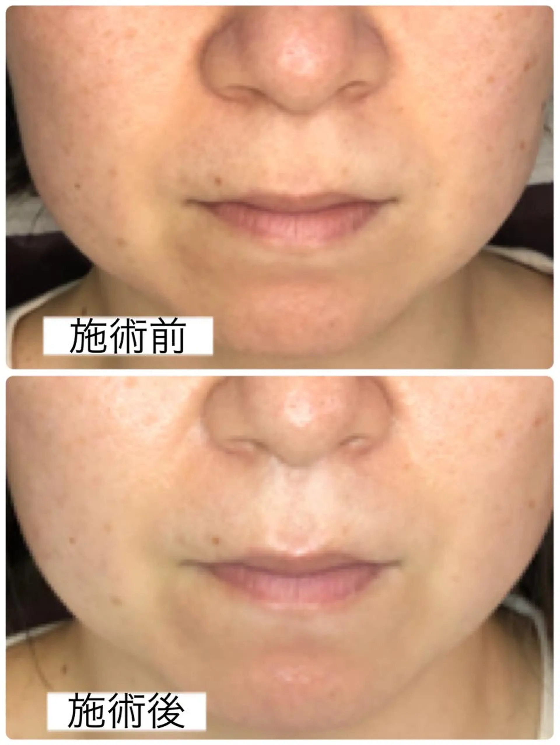 エステ 小顔・毛穴・たるみ ネイル　似内真樹のエステ・リラクイメージ