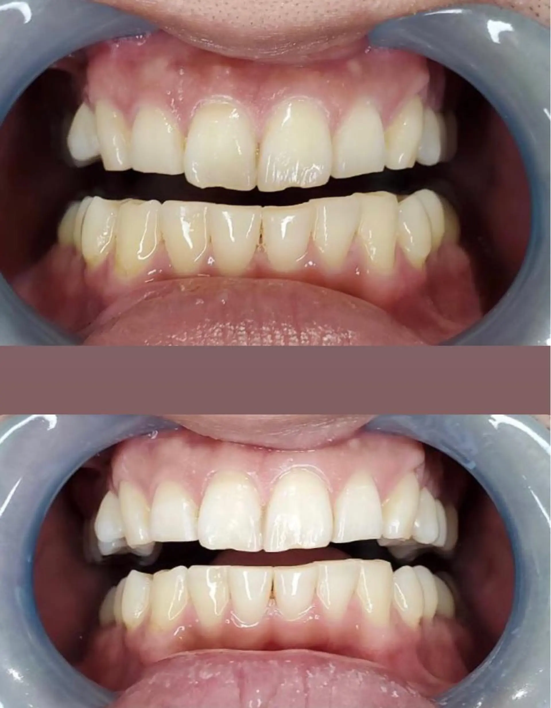 LAVISH nail salonのネイルデザイン