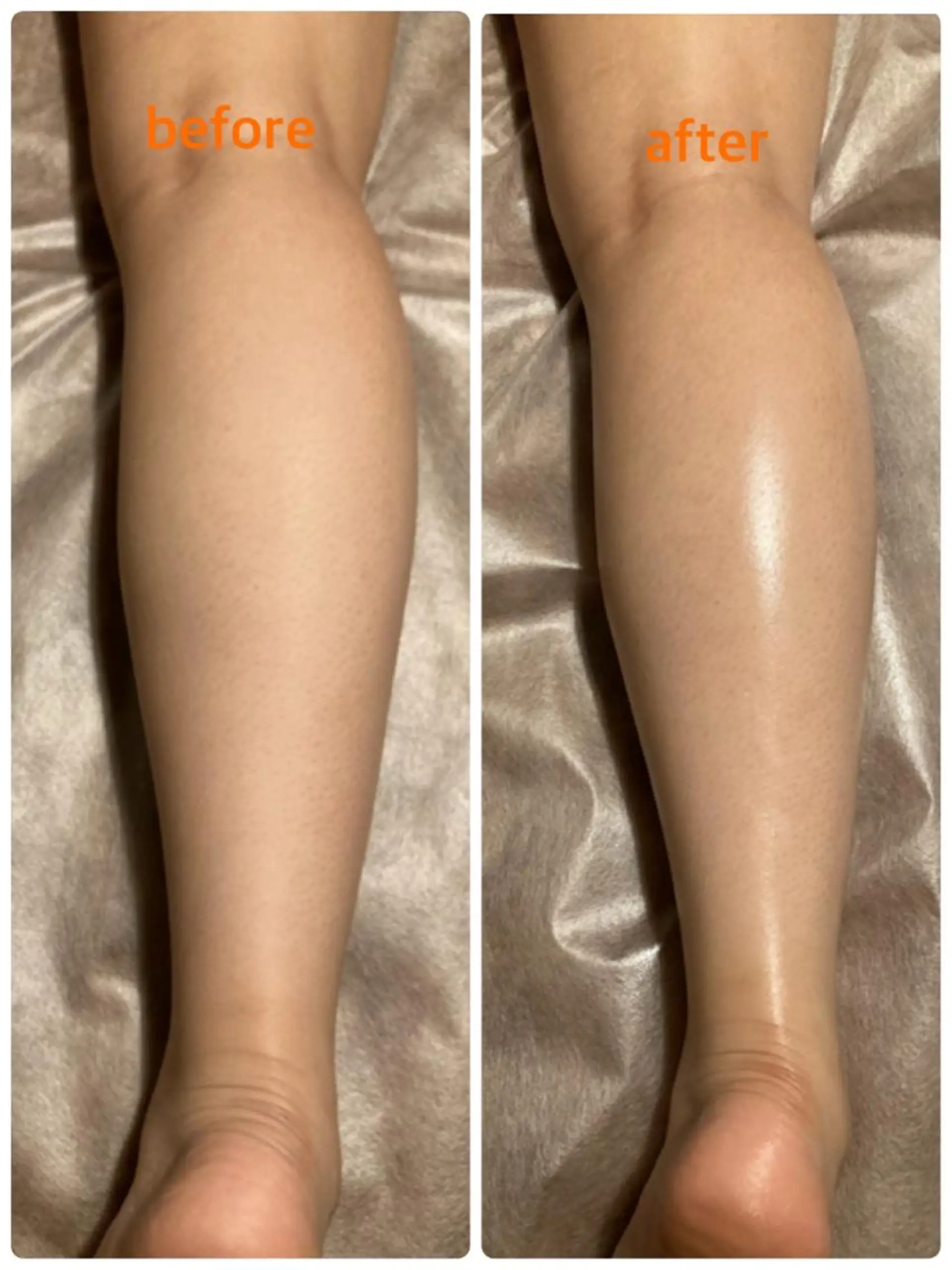 bellissimo 【ベリッシモ】所属・ちひろ　痩身/ハーブ bellissimoのエステ・リラクイメージ