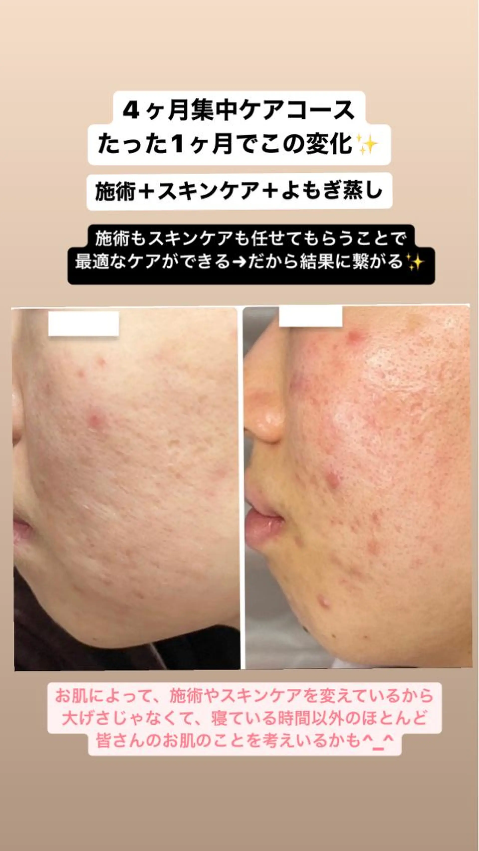 ベラージュ【美背中・ 美尻・フェイシャル】のエステ・リラクイメージ