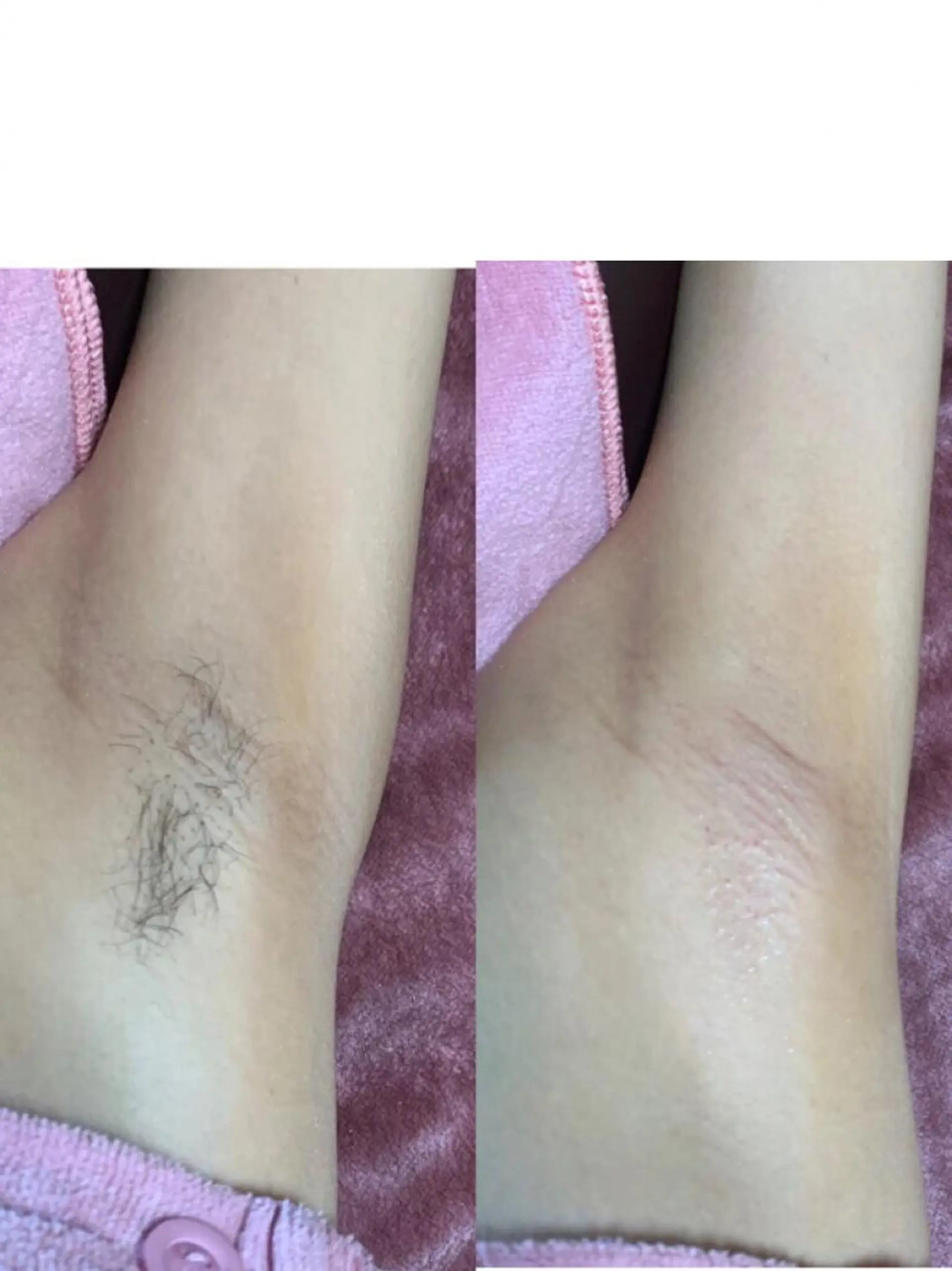 Puni 〜プーニー〜のエステ・リラクイメージ