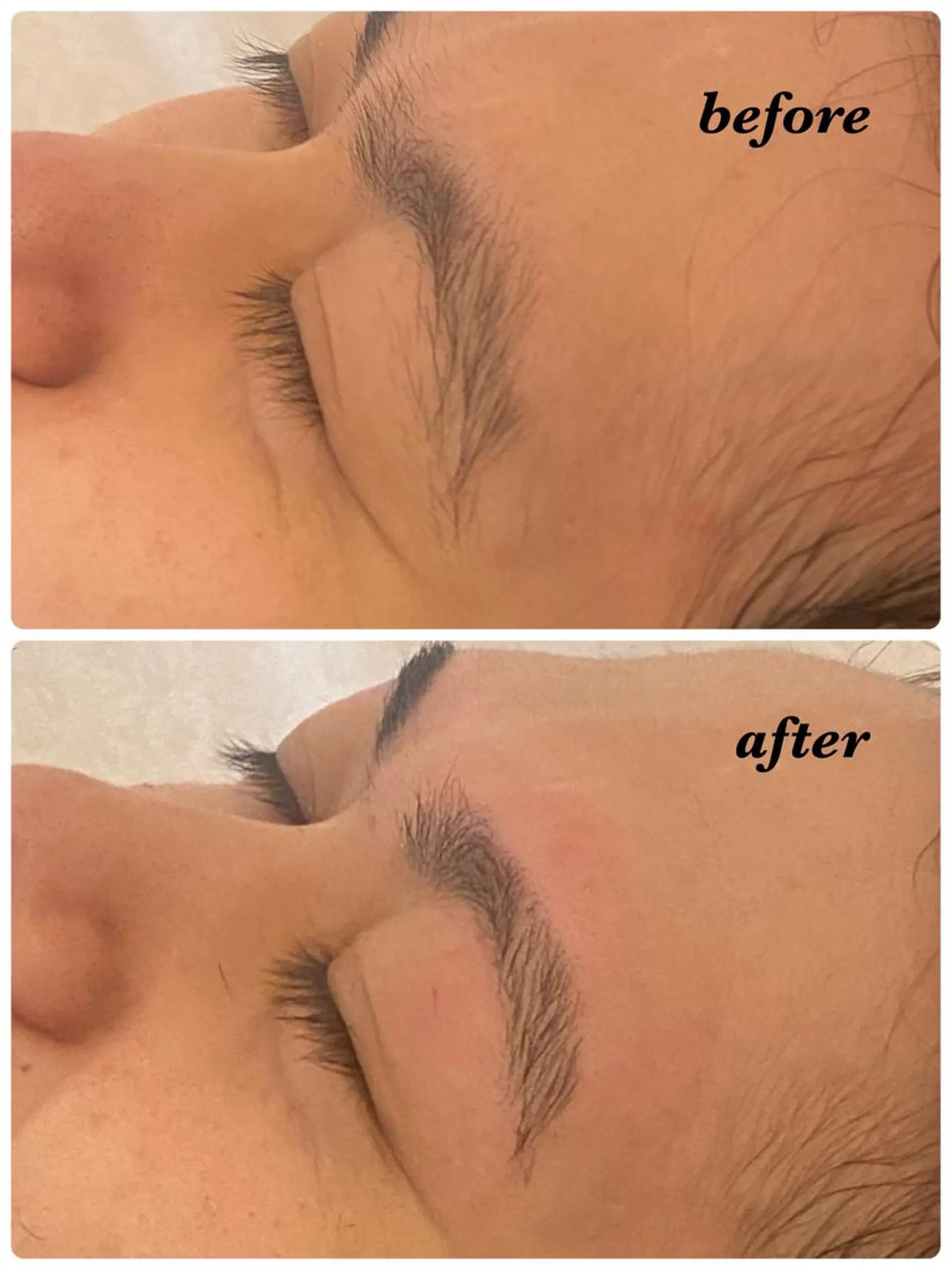 アイブロウ ハーブピーリング/韓国肌管理/フェイシャル/毛穴洗浄/眉毛/顔脱毛【糸脱毛専門】rev所属・ハーブピーリング🌹 毛穴洗浄❤️眉waxのエステ・リラクイメージ