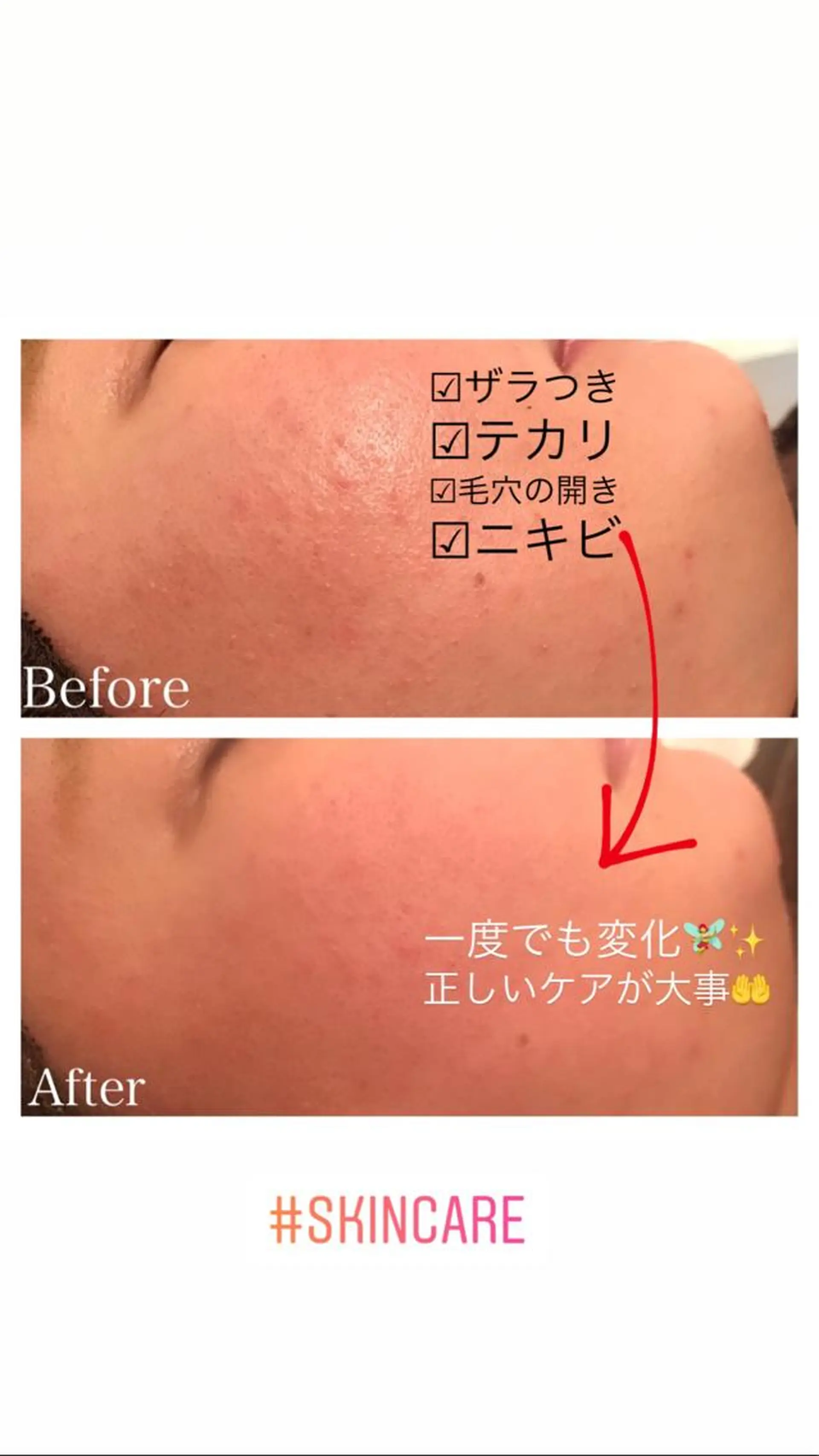 セミロング ヘアアレンジ ネイル マツエク・マツパ エステ リラク ニキビ跡専門サロン Ａｉｎａのエステ・リラクイメージ