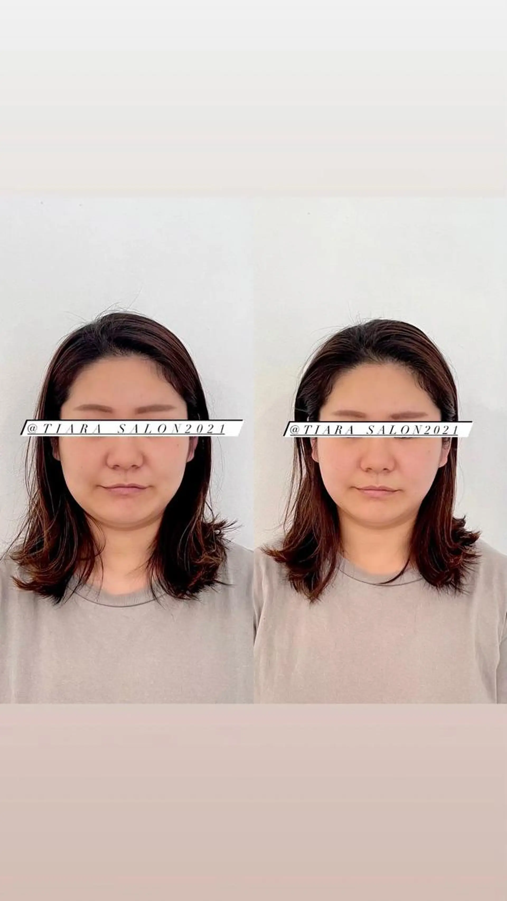 美容鍼灸サロン　TIARA所属・鍼灸サロン TIARA　美容鍼のエステ・リラクイメージ