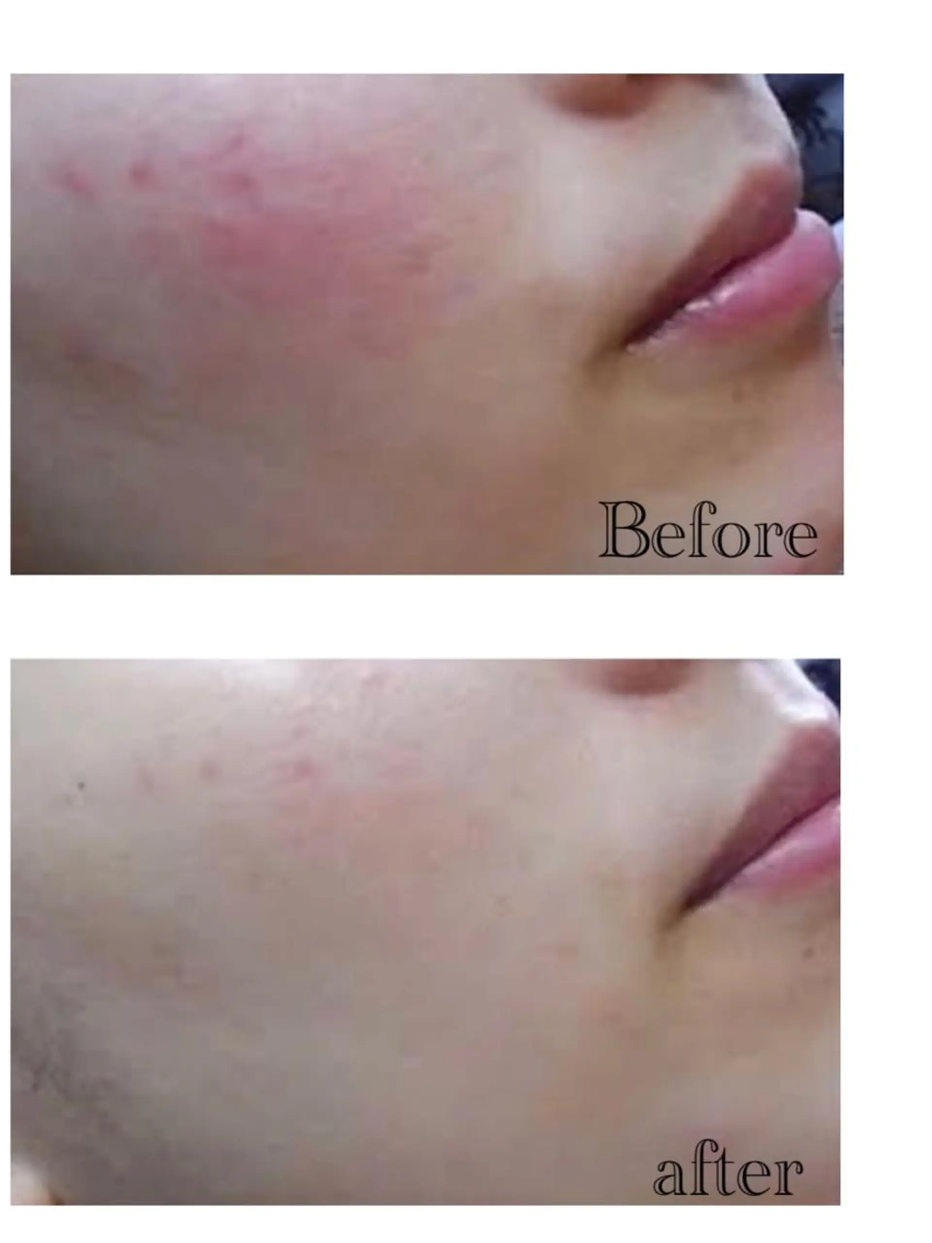 アクシア ビューティー サロン所属・究極のアンチエイ ジングサロンのエステ・リラクイメージ