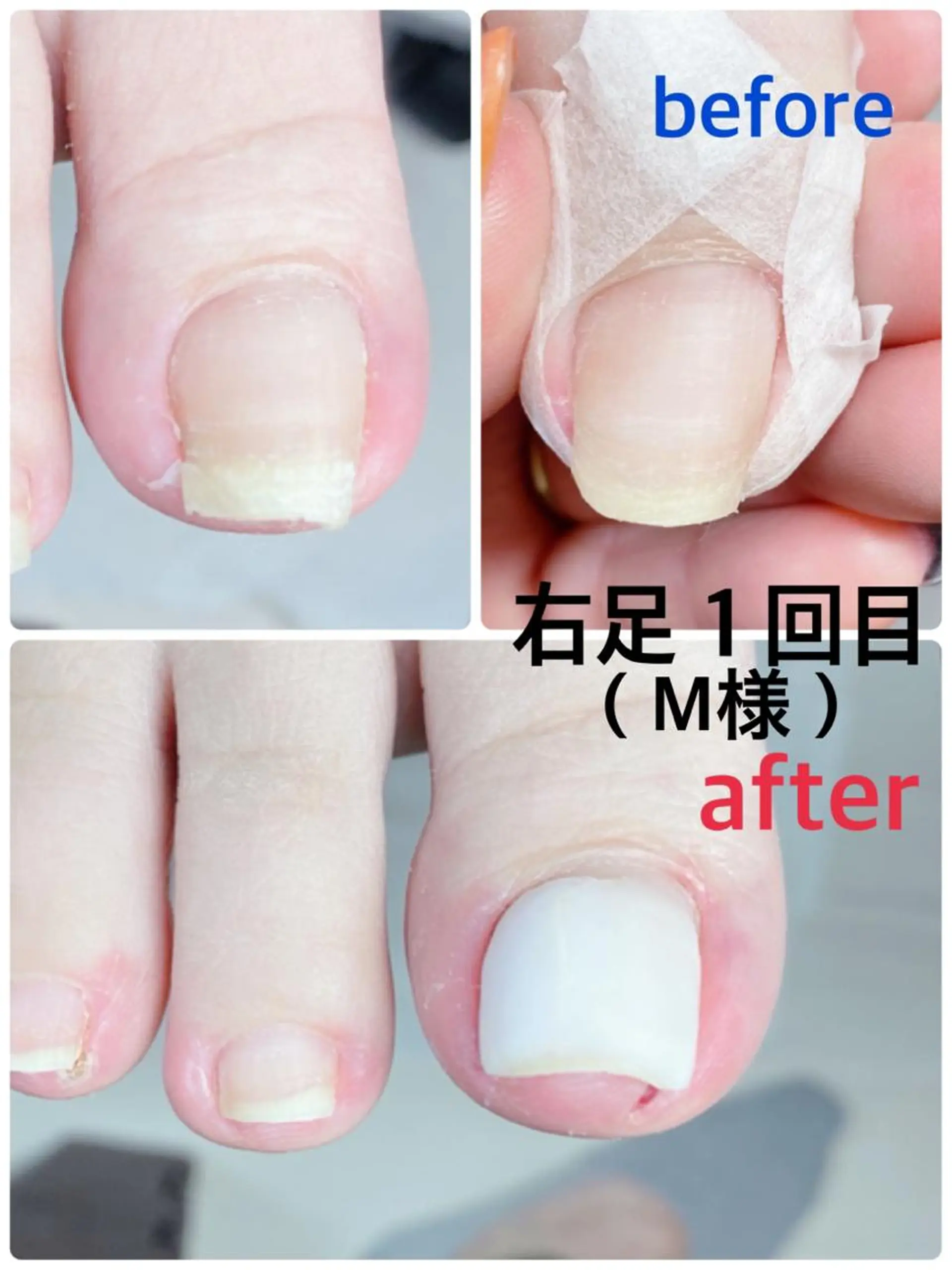 ネイル フットネイル 柴崎 美幸のネイルデザイン