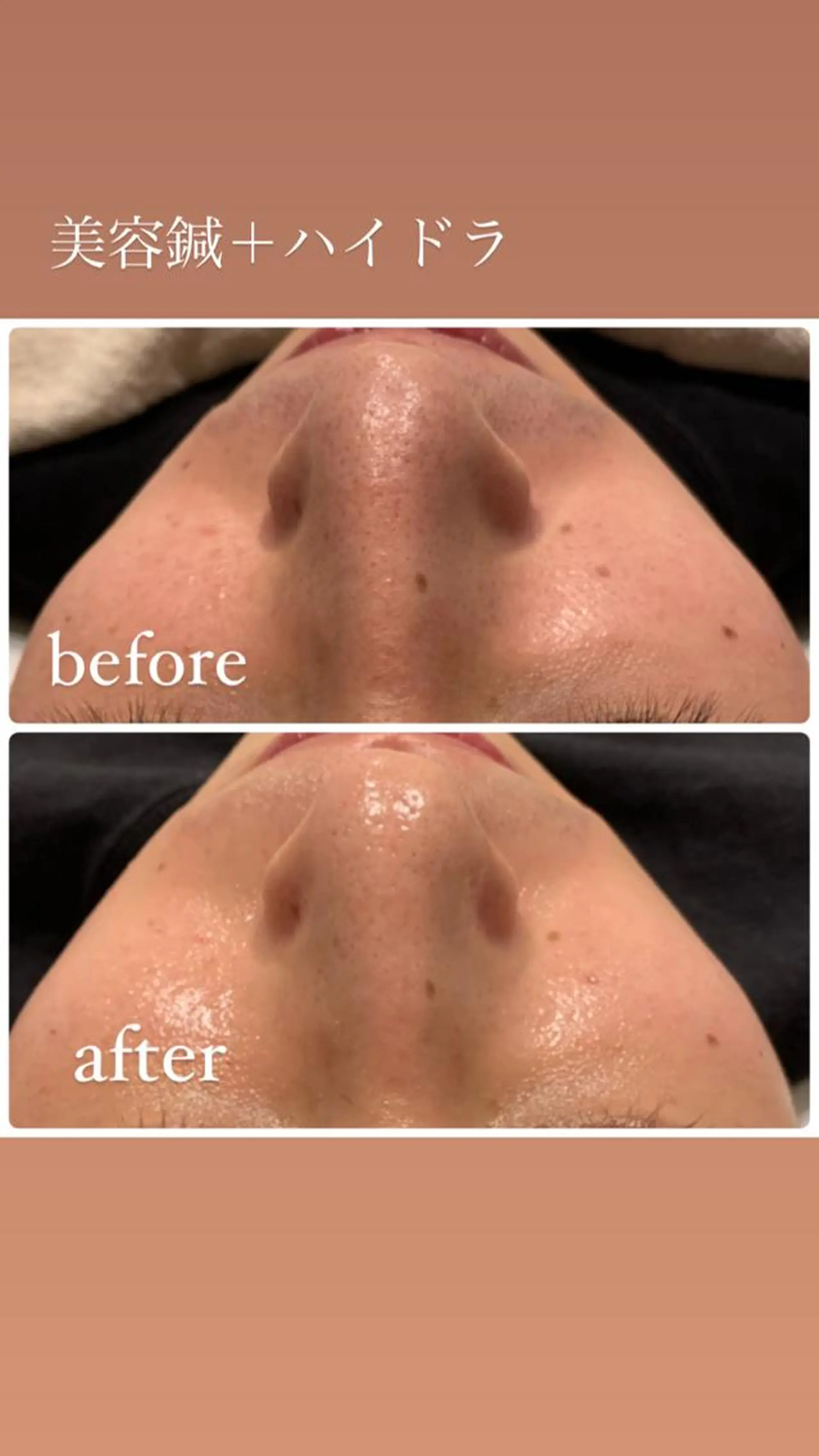 その他 種市 貴子のその他イメージ