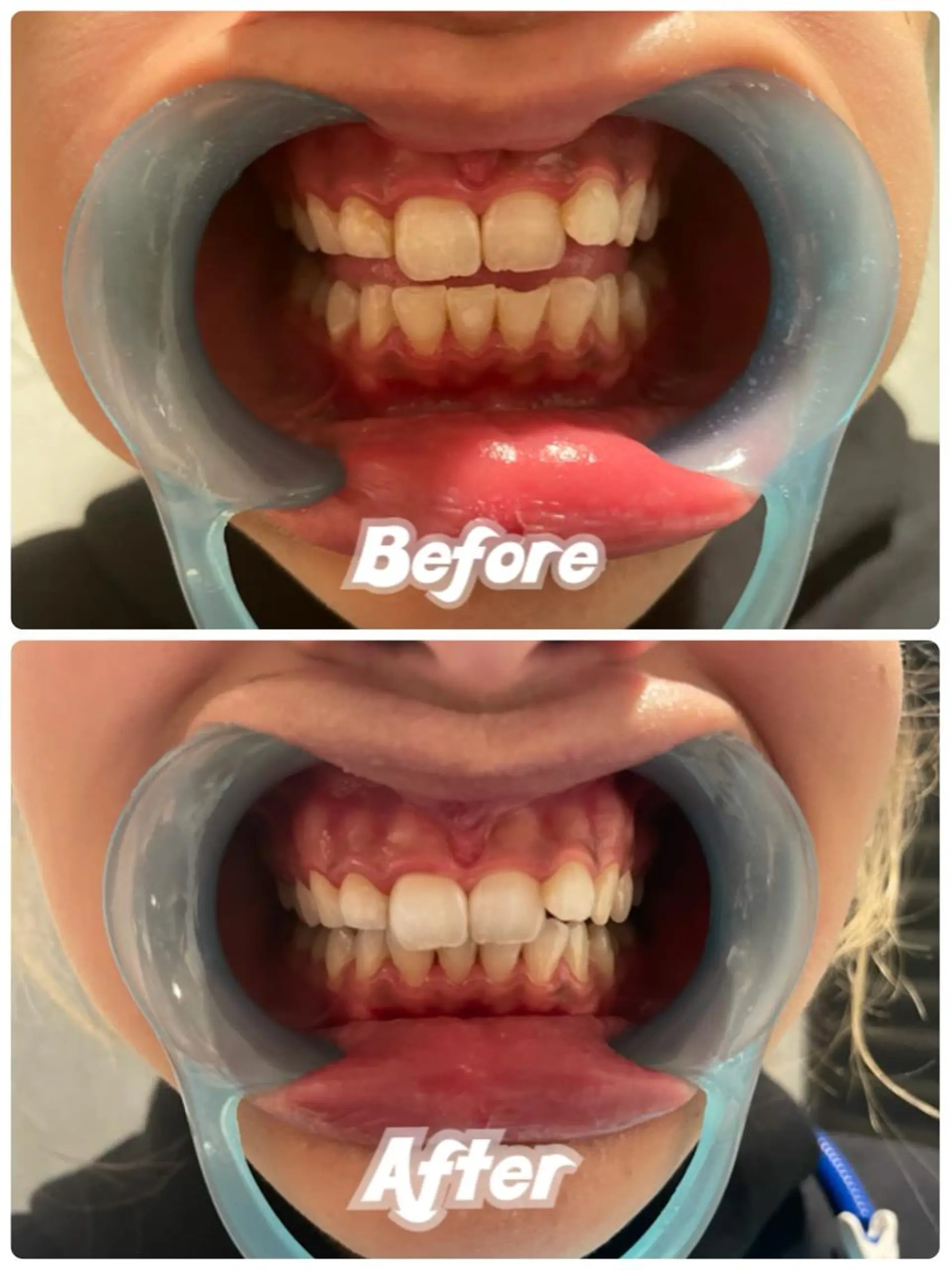 その他 石川 タイナのその他イメージ