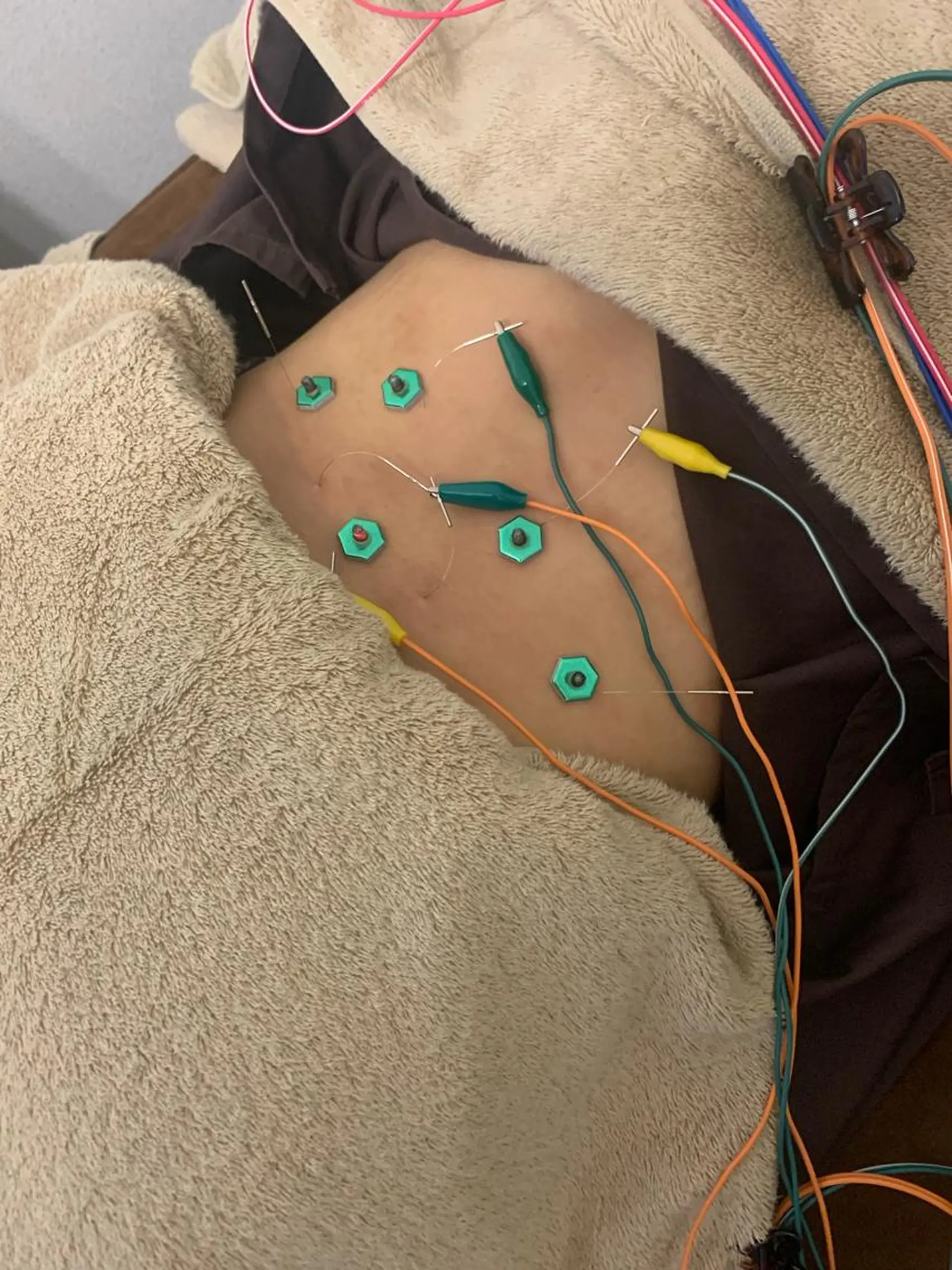 表参道鍼灸院K 美容鍼🔮ララピールのエステ・リラクイメージ