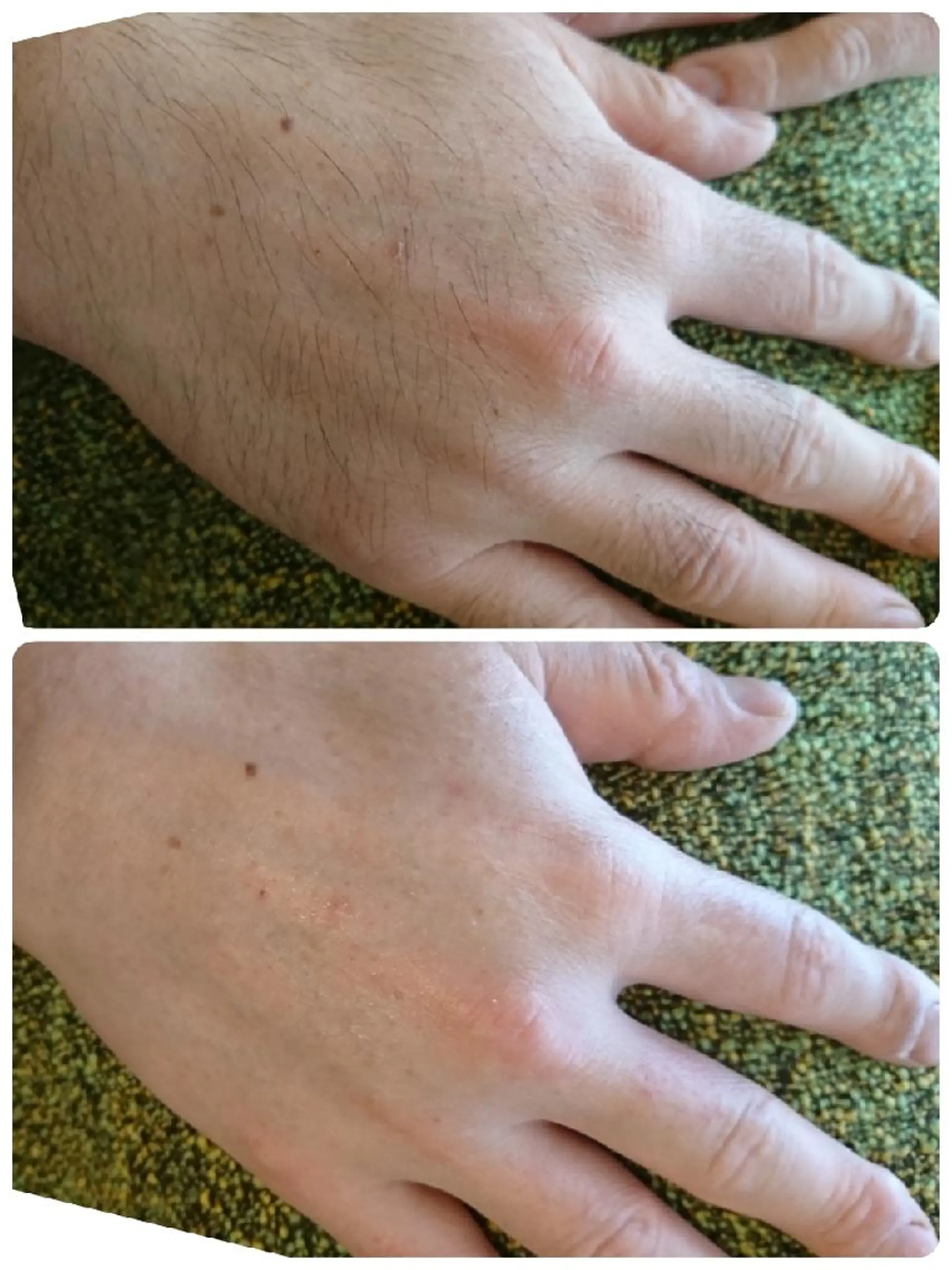 メンズ 脱毛 Lutella所属・ワックス脱毛専門店 Lutellaのエステ・リラクイメージ