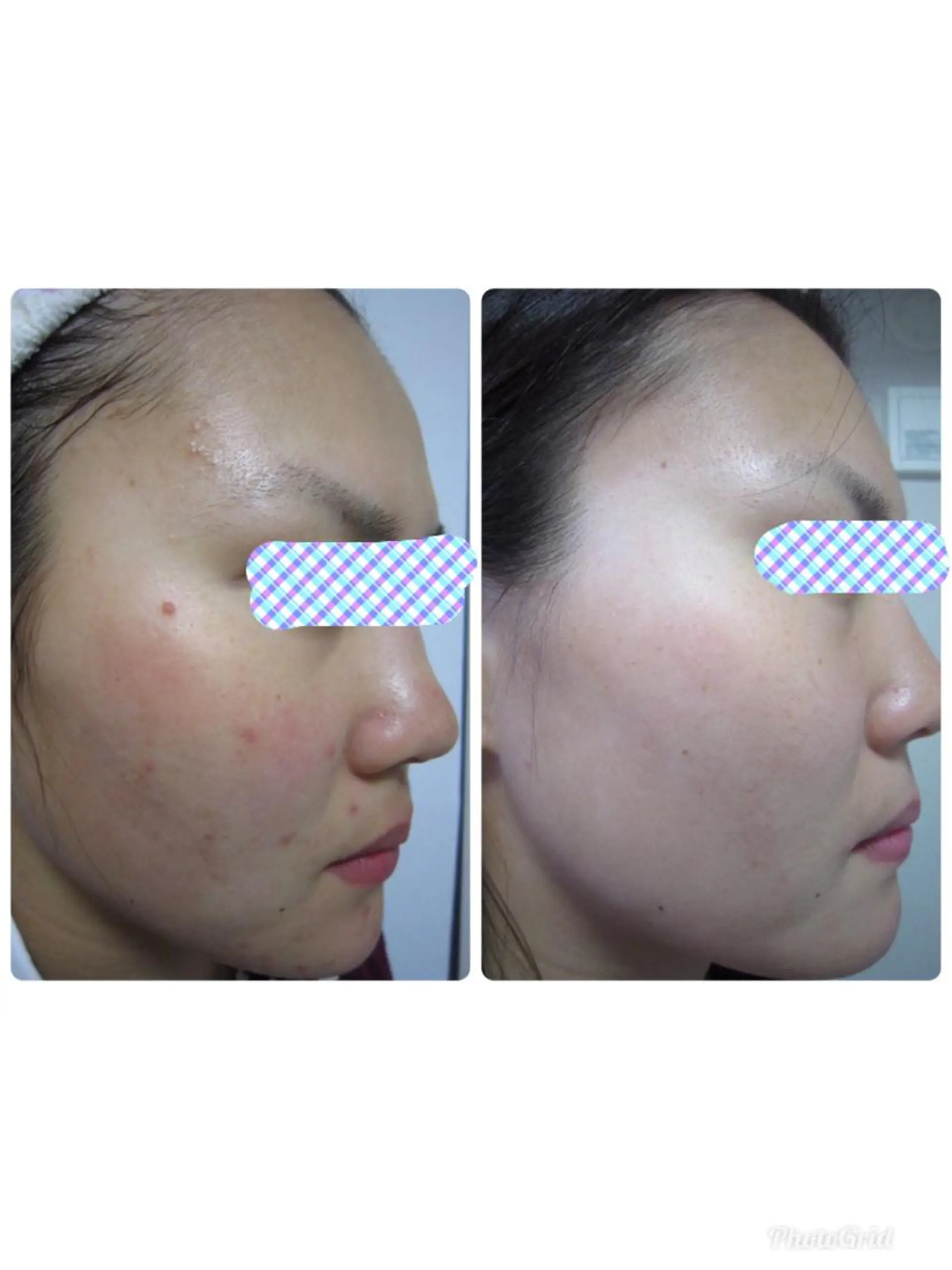 Facial stylist salon伊勢崎所属・中島 有希のエステ・リラクイメージ