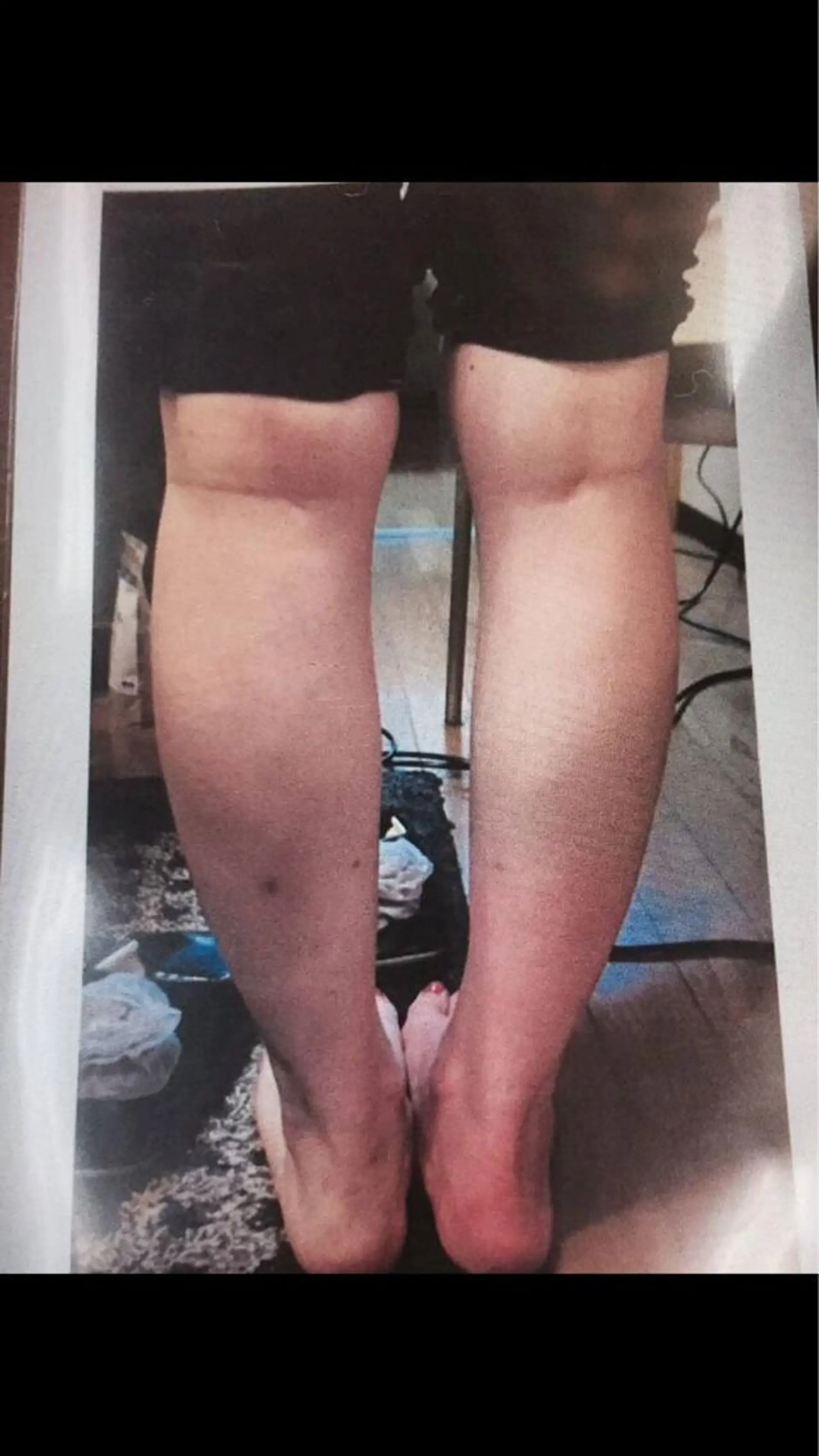 エステ リラク ヨサパーク  ルフ楢原店所属・水素×よもぎ蒸し YOSAPARKルフのエステ・リラクイメージ