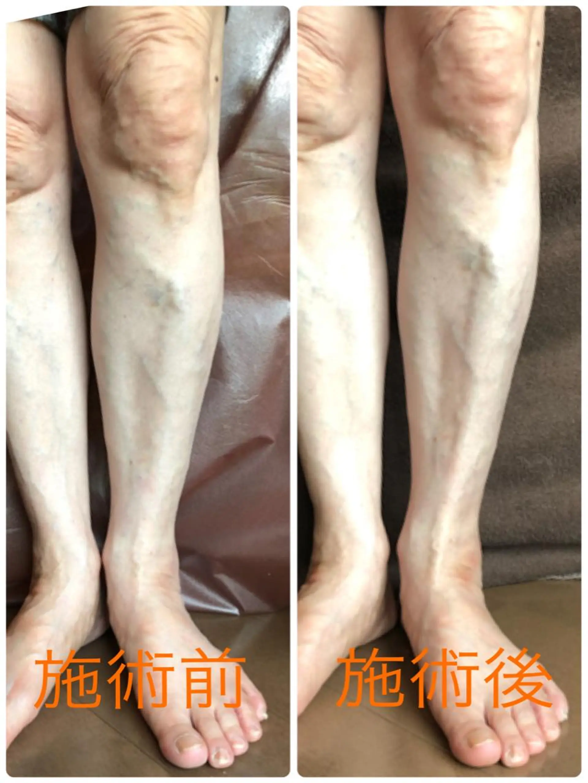 小顔・毛穴・たるみ ネイル　似内真樹のエステ・リラクイメージ