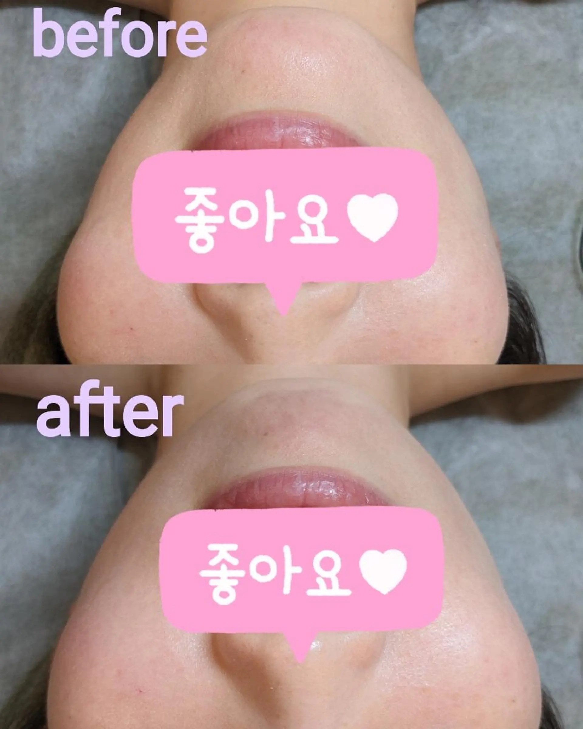 プライベートサロン宿り木所属・江坂@宿り木　脱毛＆ 耳ツボジュエリーのその他イメージ