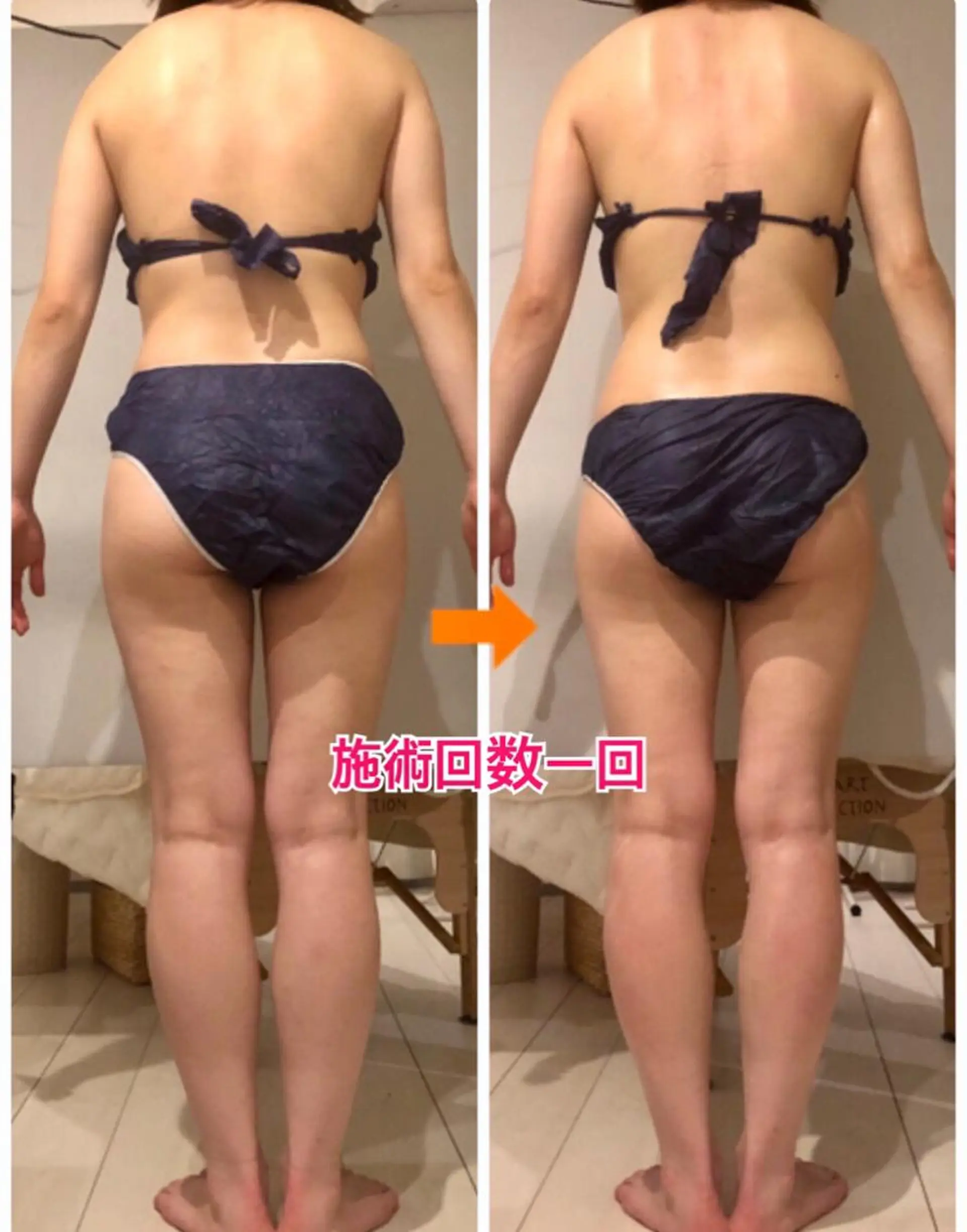 ロング カラー パーマ ヘアアレンジ メンズ キッズ ネイル マツエク・マツパ ‍痩身＆ボディ 結果出し🌟丹野のエステ・リラクイメージ