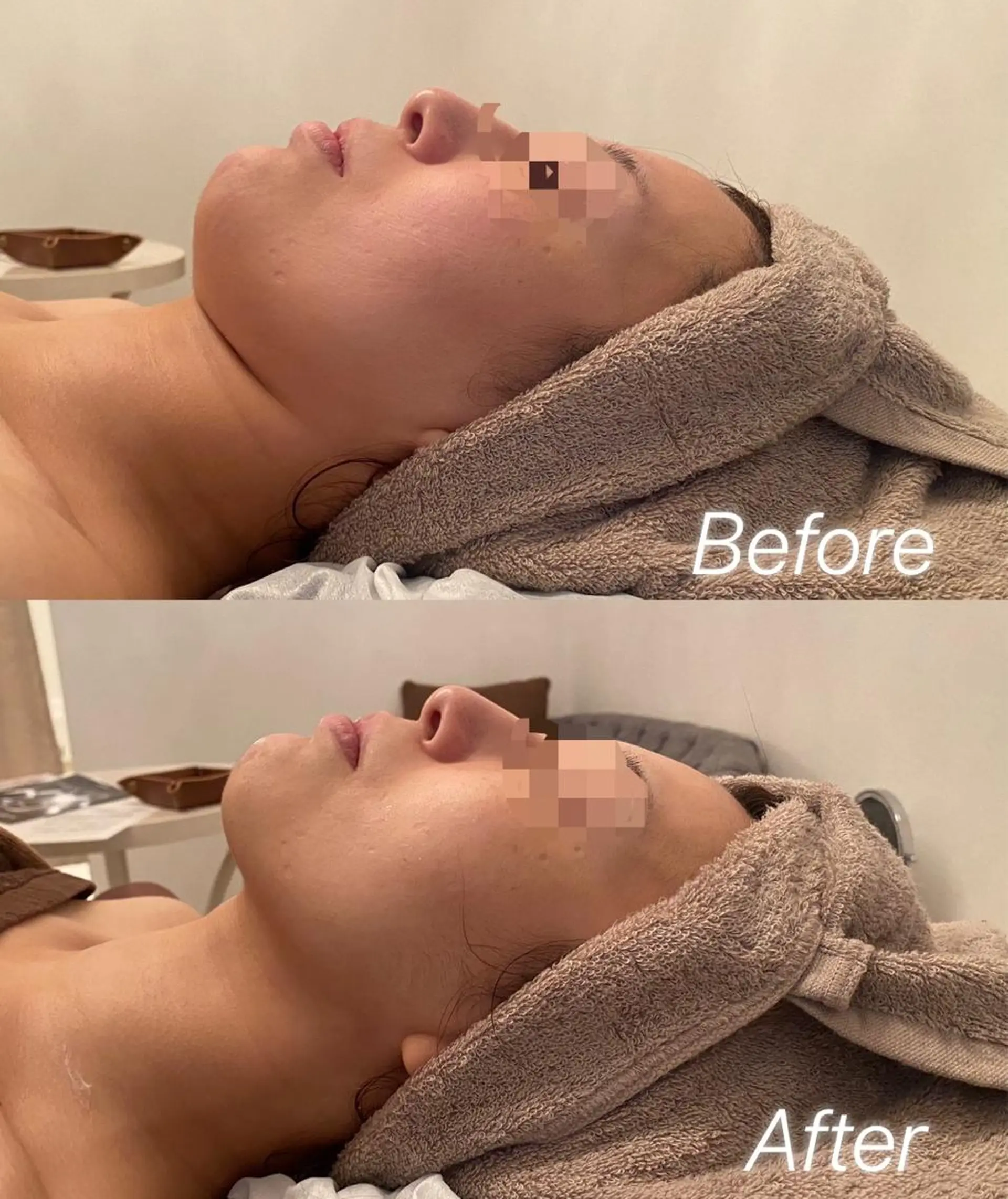 Remina clinical salon所属・ハイフ美肌専門 Remina.c.sのエステ・リラクイメージ