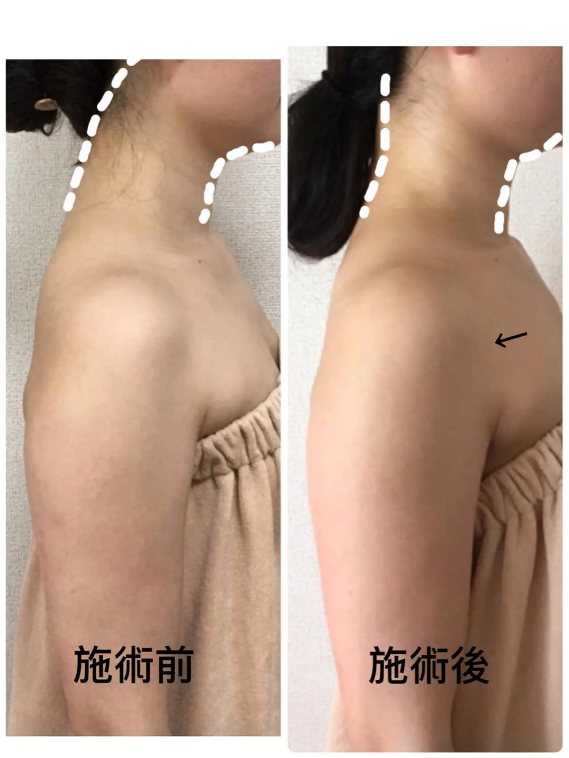 美筋骨格リンパ®️ Aroleのエステ・リラクイメージ