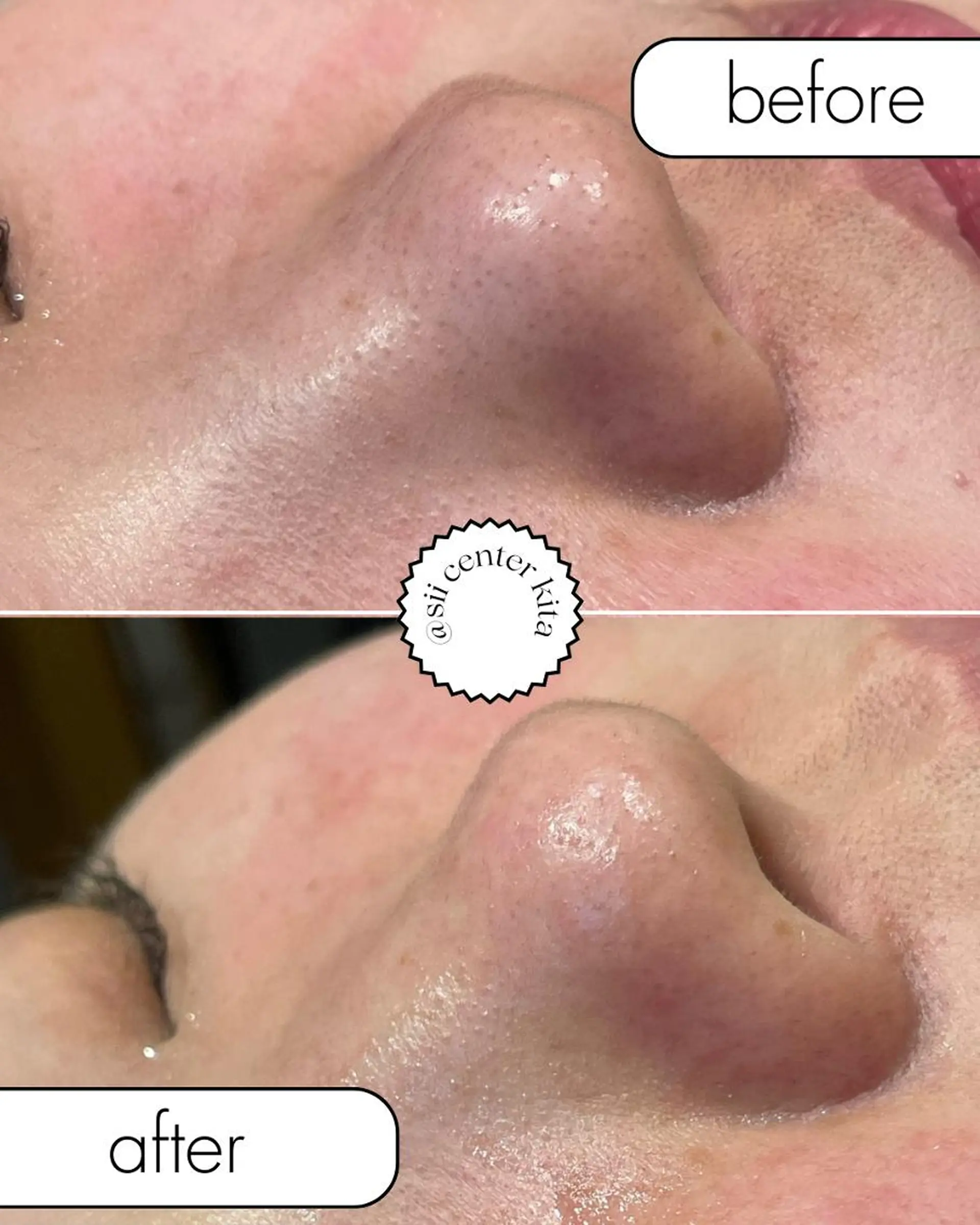 エステ sii MIUのエステ・リラクイメージ