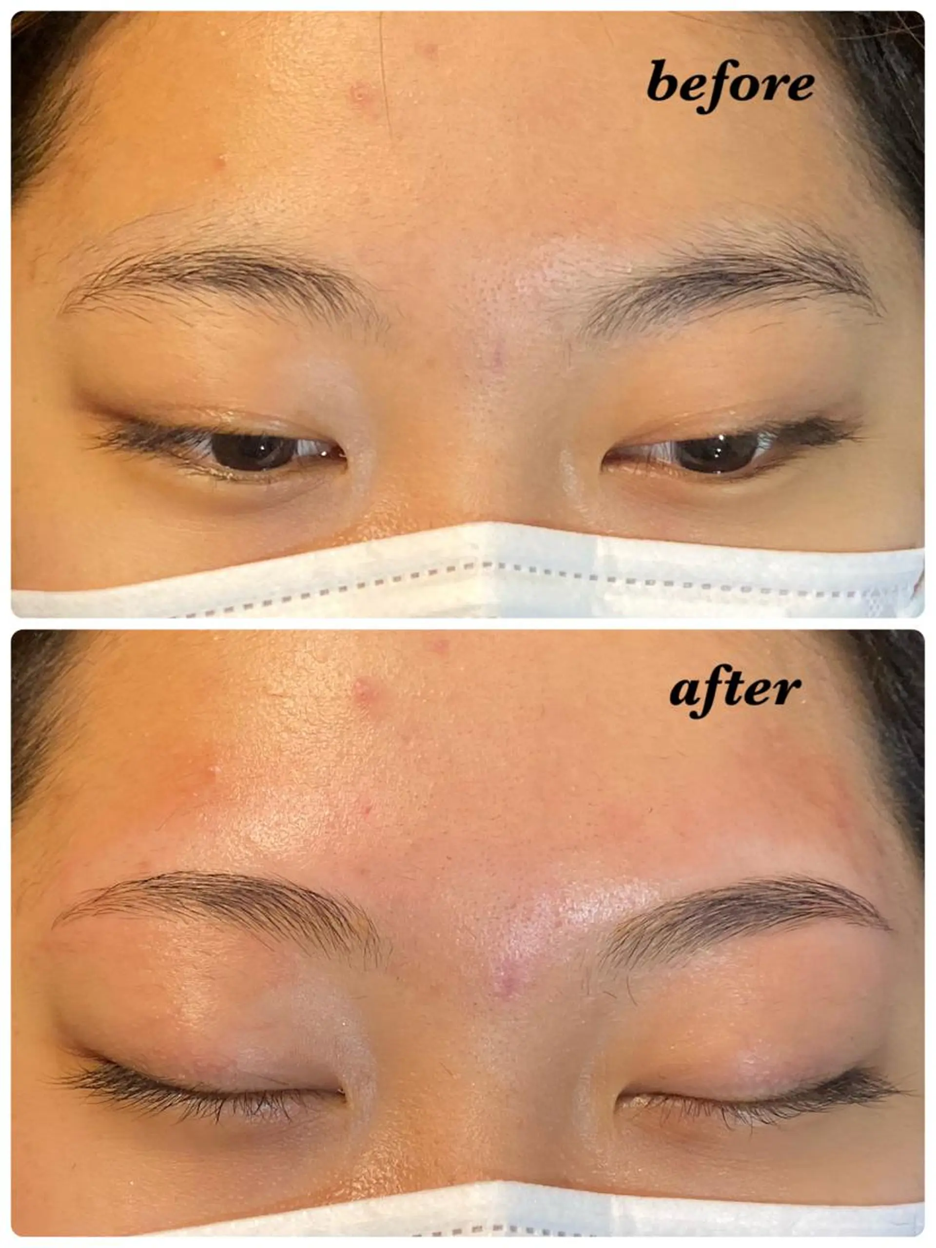 アイブロウ ハーブピーリング/韓国肌管理/フェイシャル/毛穴洗浄/眉毛/顔脱毛【糸脱毛専門】rev所属・ハーブピーリング🌹 毛穴洗浄❤️眉waxのエステ・リラクイメージ