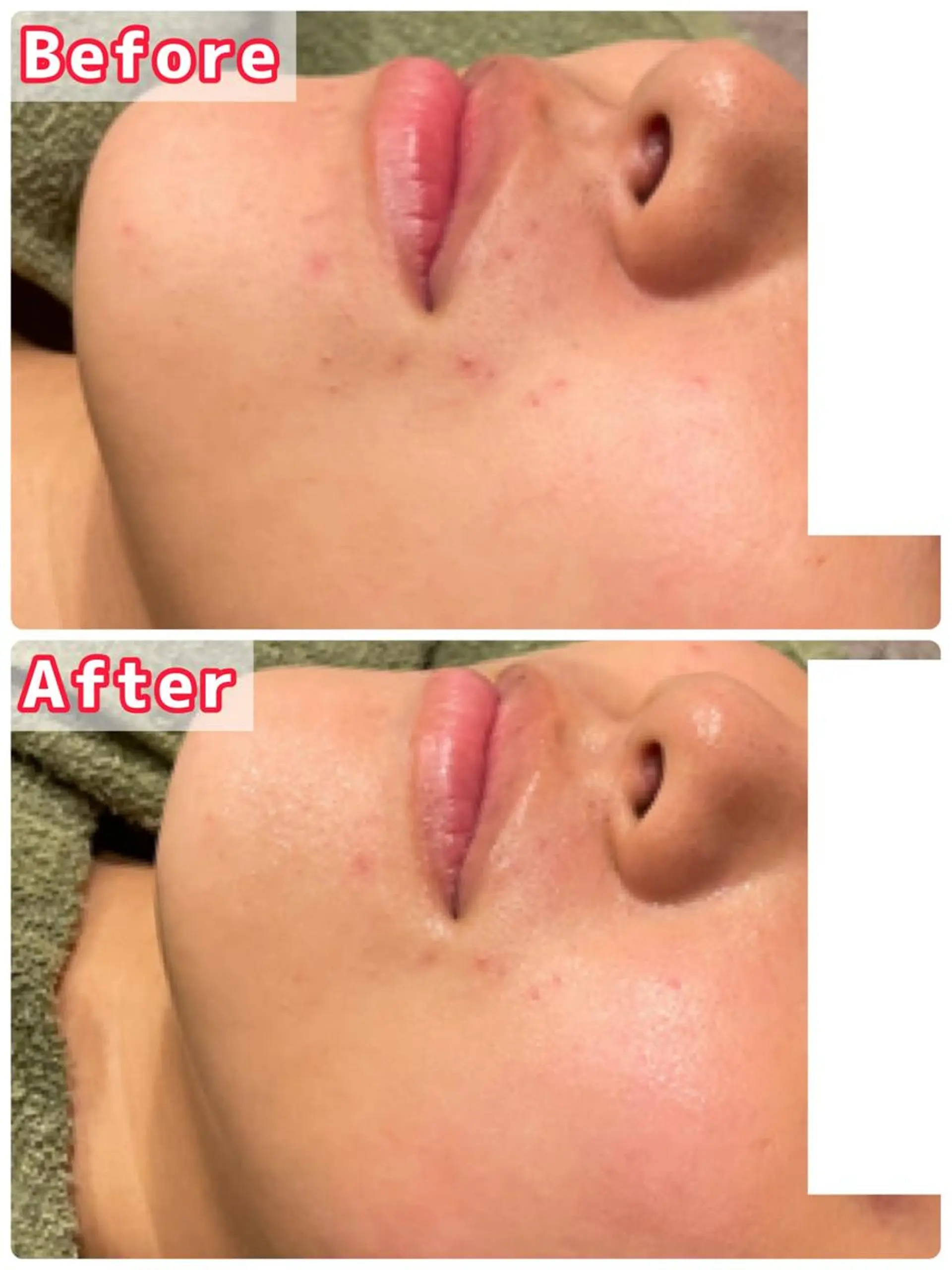 ハーブピーリング専門 muro.のエステ・リラクイメージ